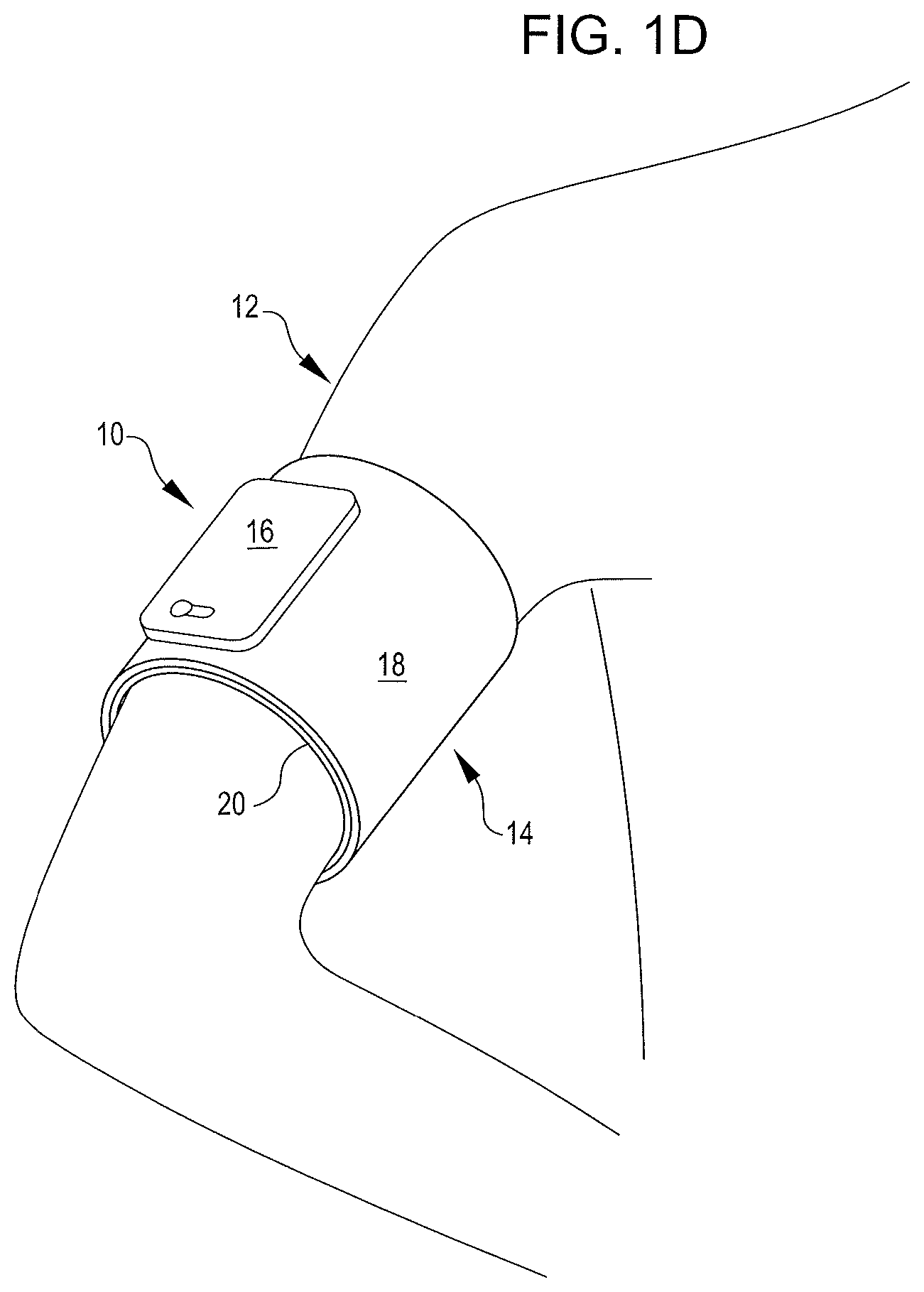 Patent US12588825 Figure 3 – Inflatable cuffs with controllable extensibility