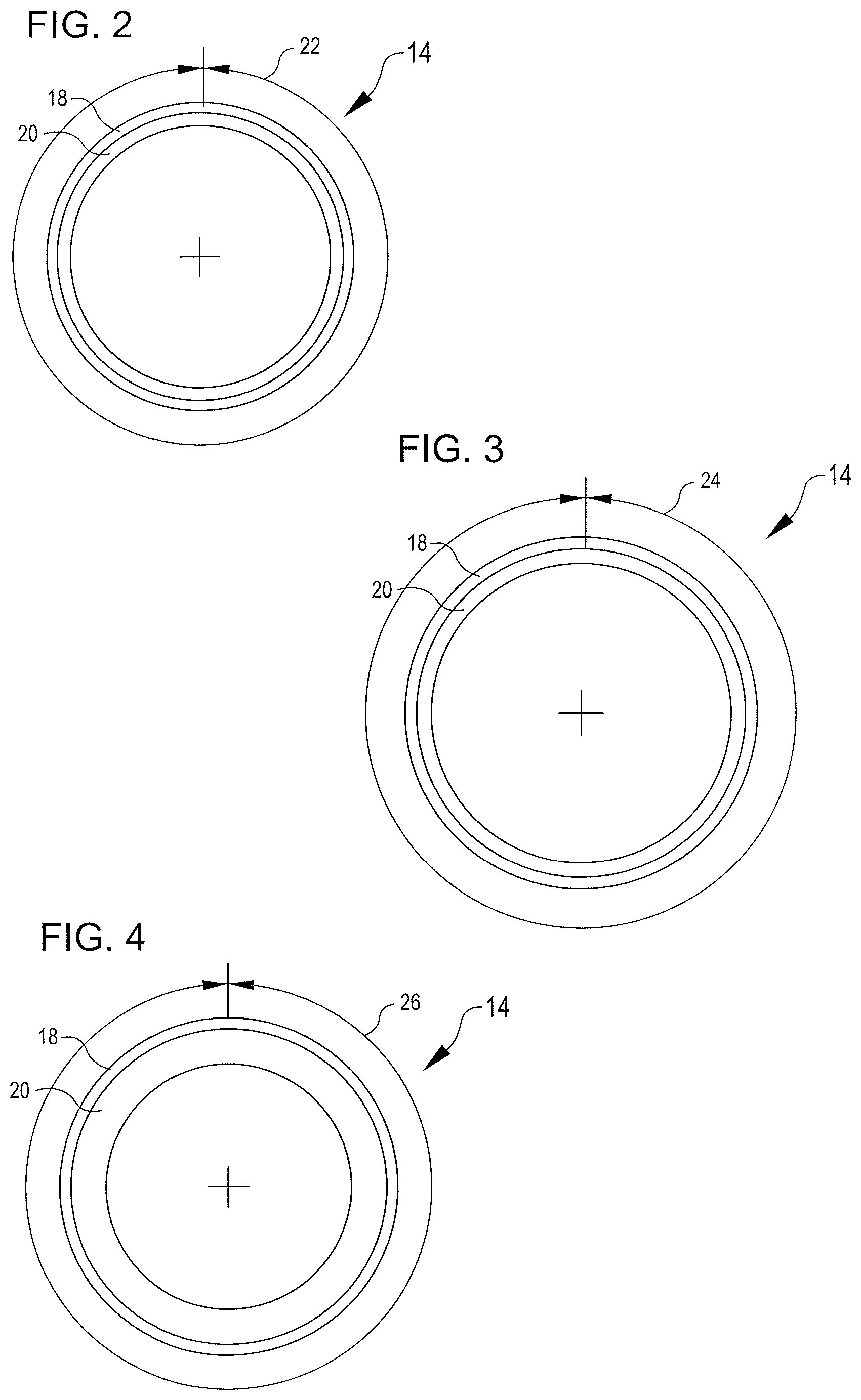 Patent US12588825 Figure 4 – Inflatable cuffs with controllable extensibility
