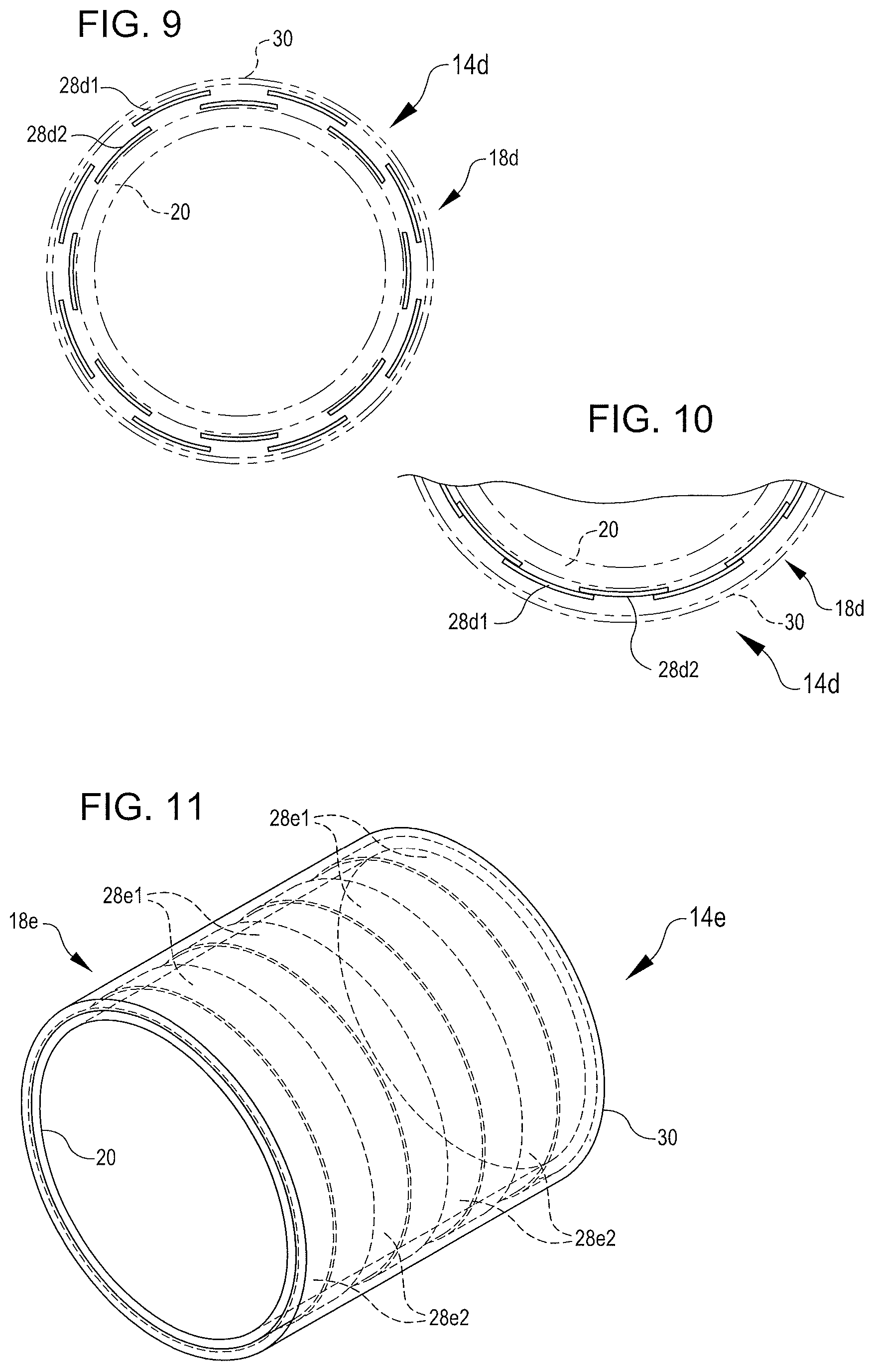 Patent US12588825 Figure 7 – Inflatable cuffs with controllable extensibility