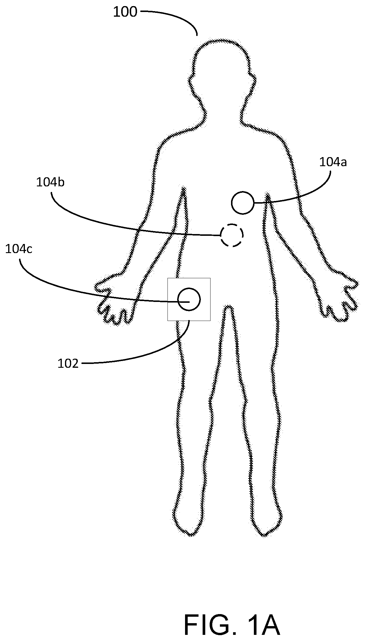 Patent US12588827 — Determining different sleep stages in a wearable medical device patient — Figure 1