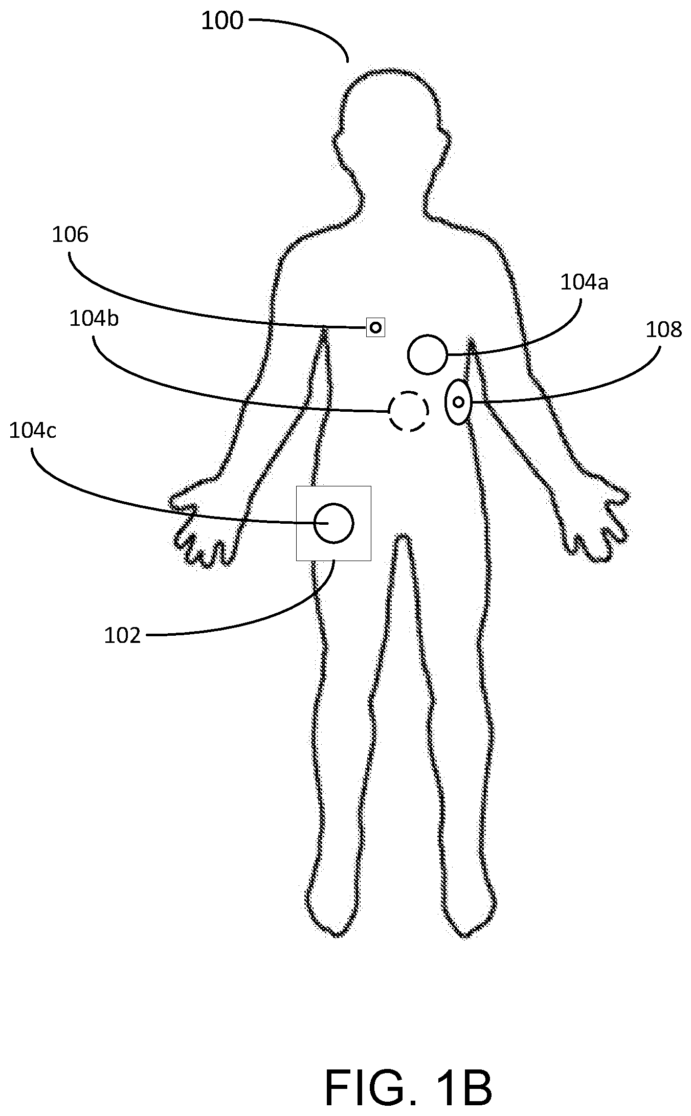 Patent US12588827 Figure 2 – Determining different sleep stages in a wearable medical device patient