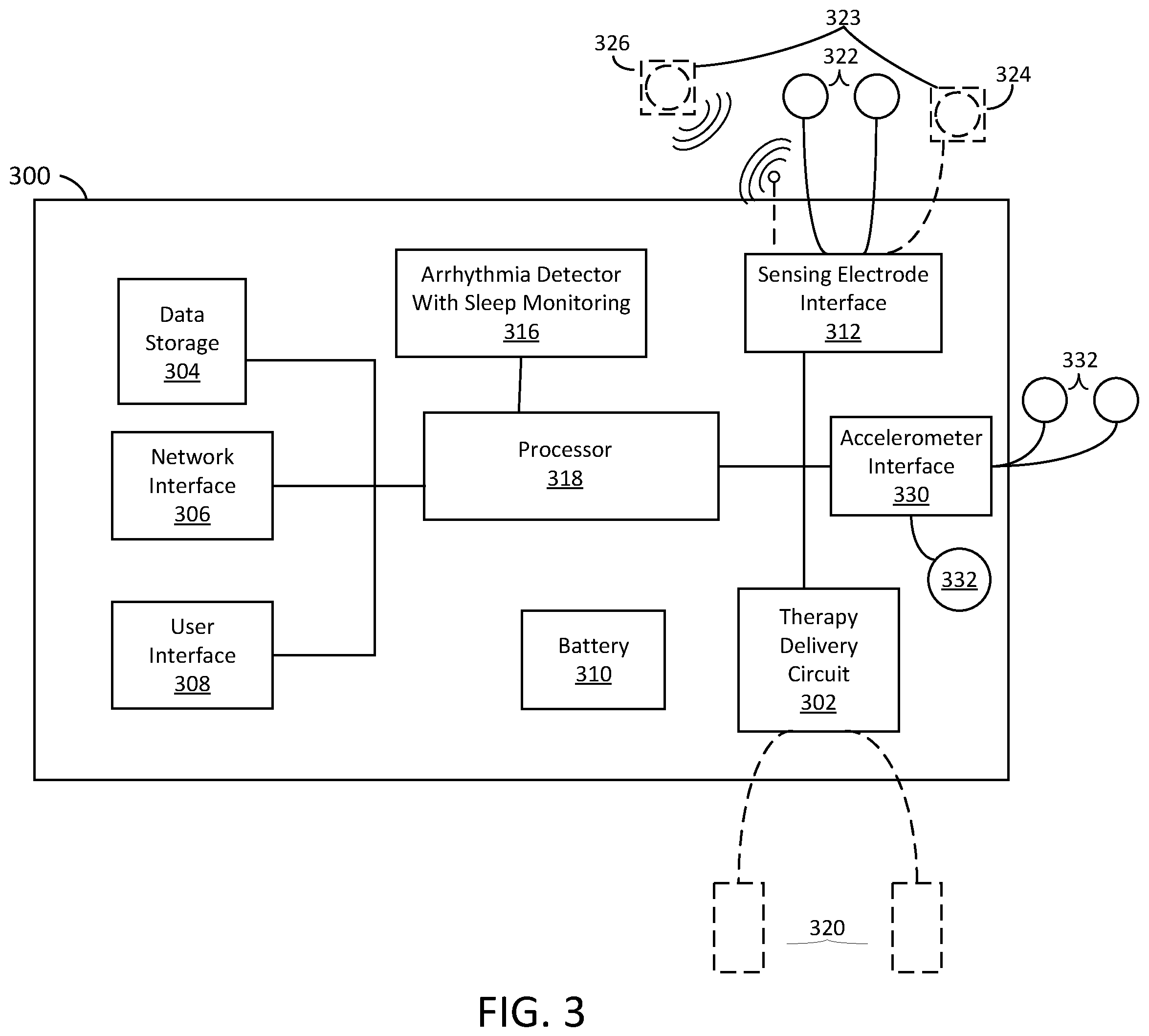 Patent US12588827 Figure 4 – Determining different sleep stages in a wearable medical device patient