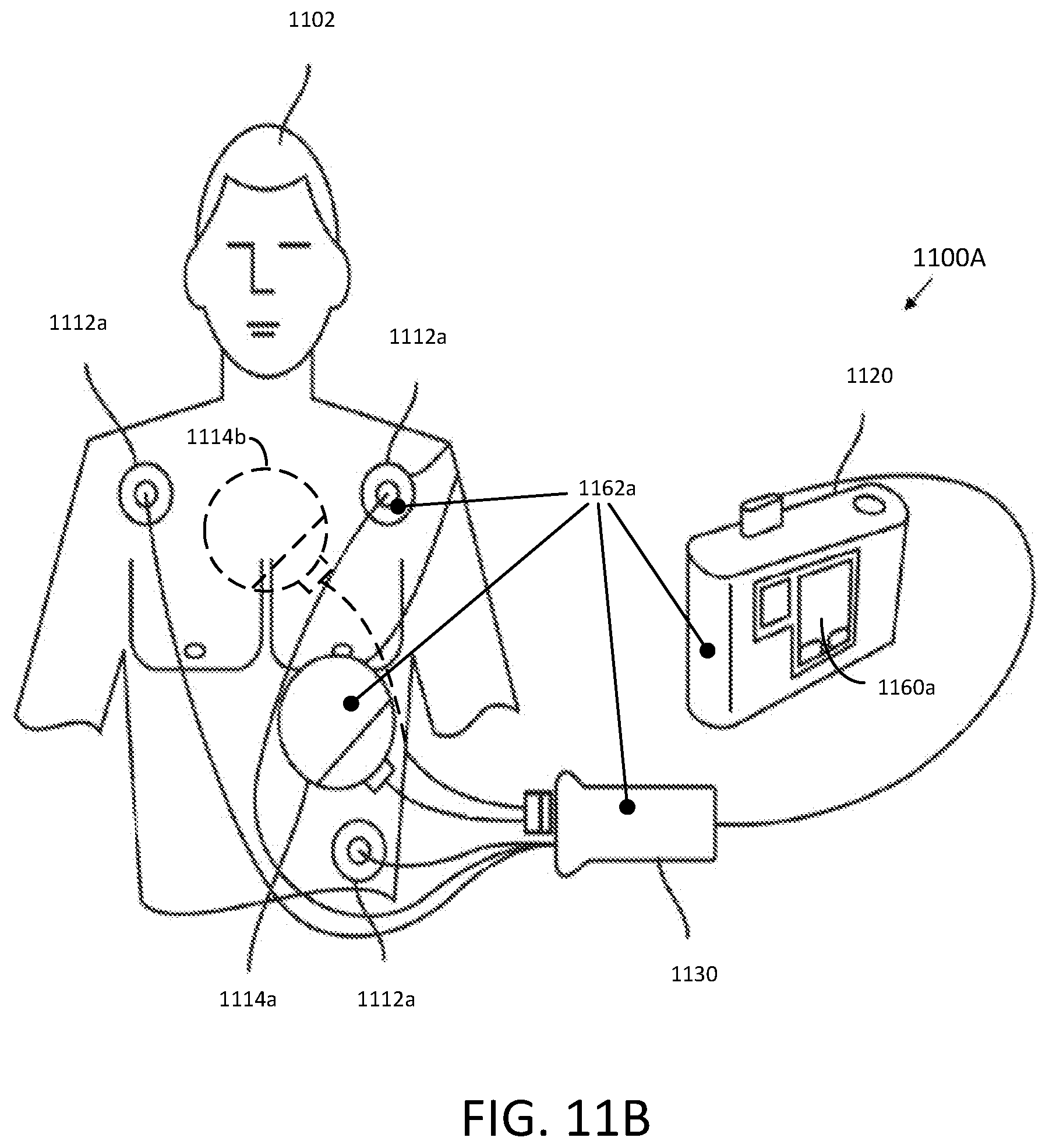 Patent US12588827 Figure 16 – Determining different sleep stages in a wearable medical device patient