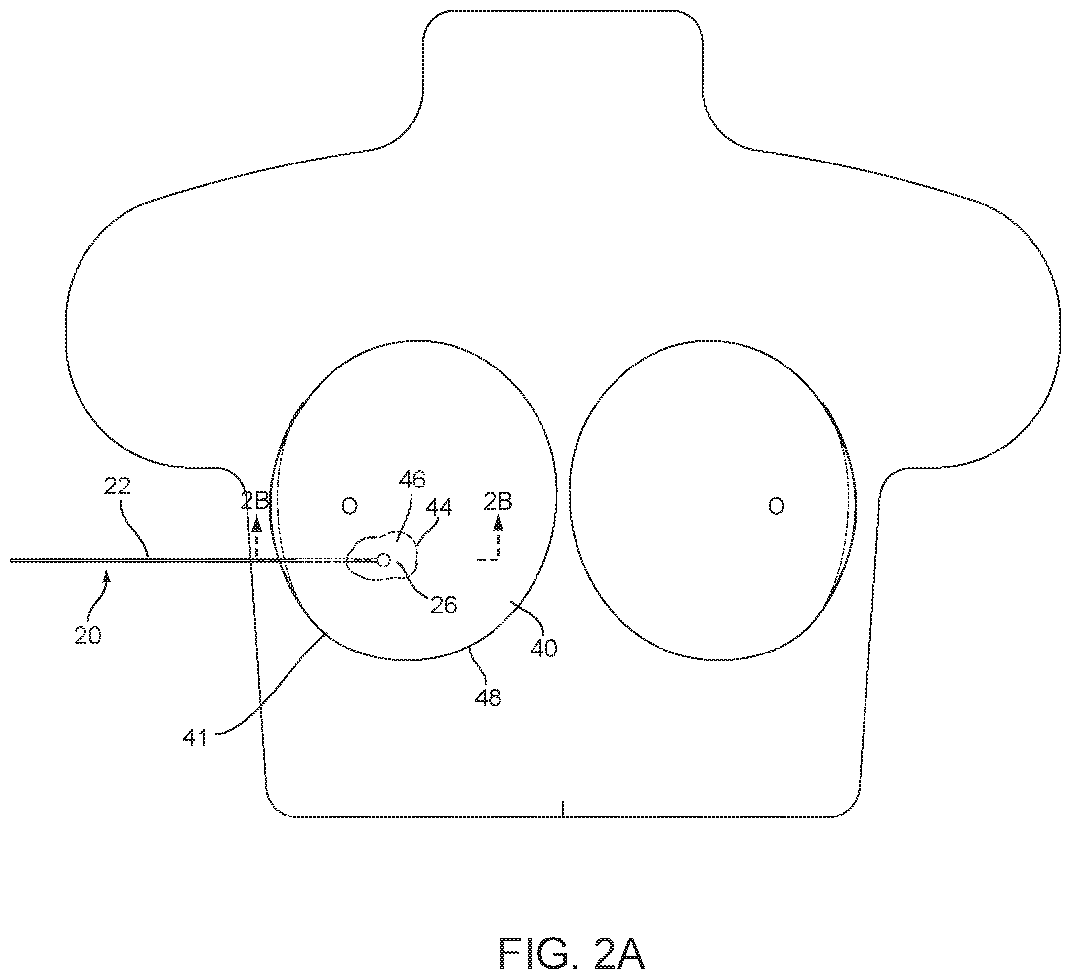 Patent US12588829 Figure 2 – Apparatus, systems, and methods for localizing markers or tissue structures within a body