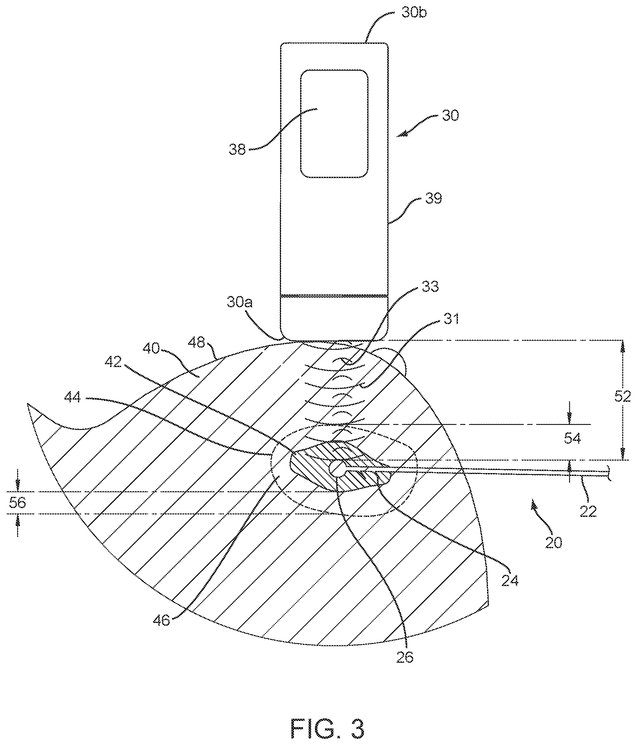 Patent US12588829 Figure 4 – Apparatus, systems, and methods for localizing markers or tissue structures within a body
