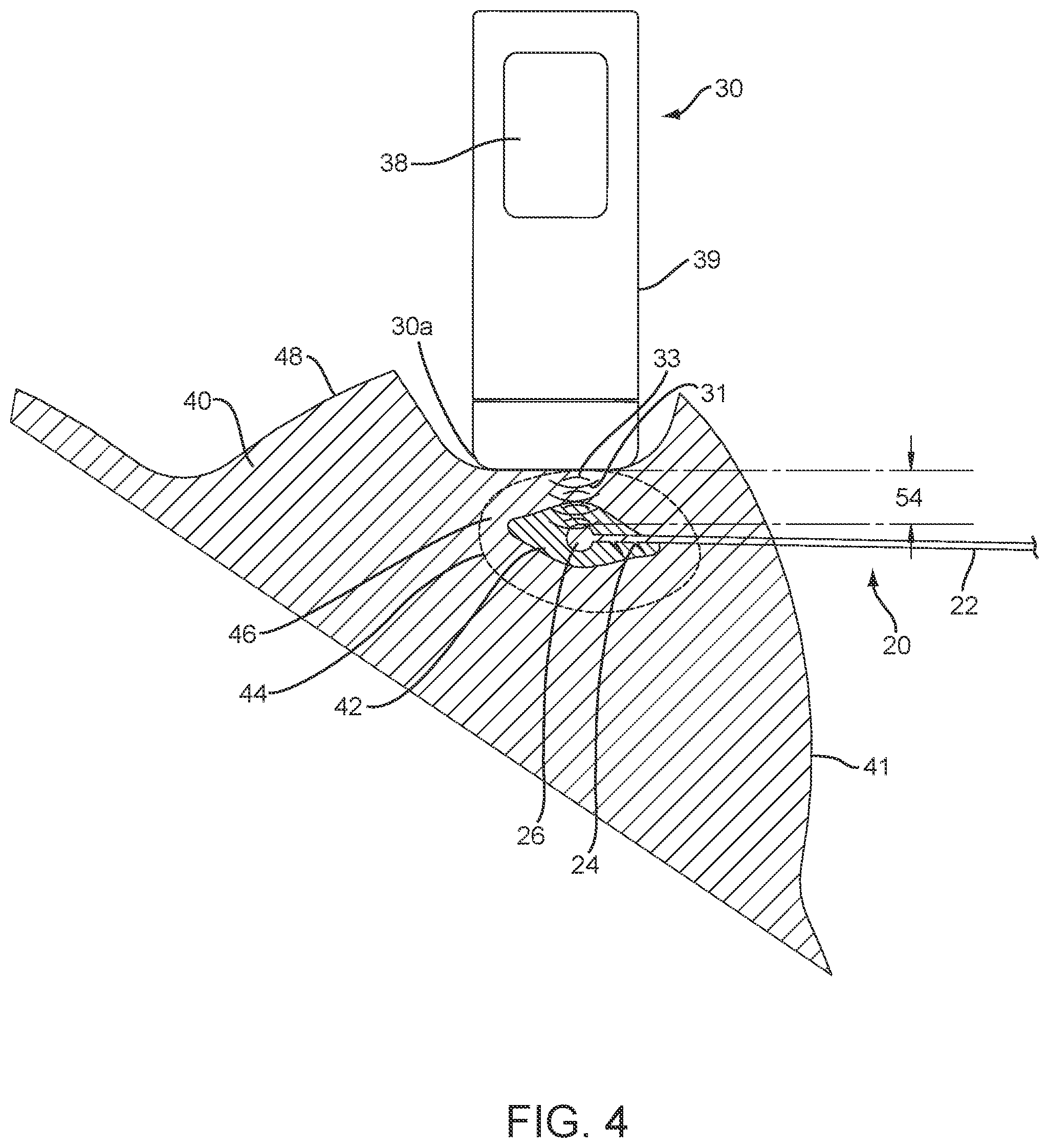 Patent US12588829 Figure 5 – Apparatus, systems, and methods for localizing markers or tissue structures within a body