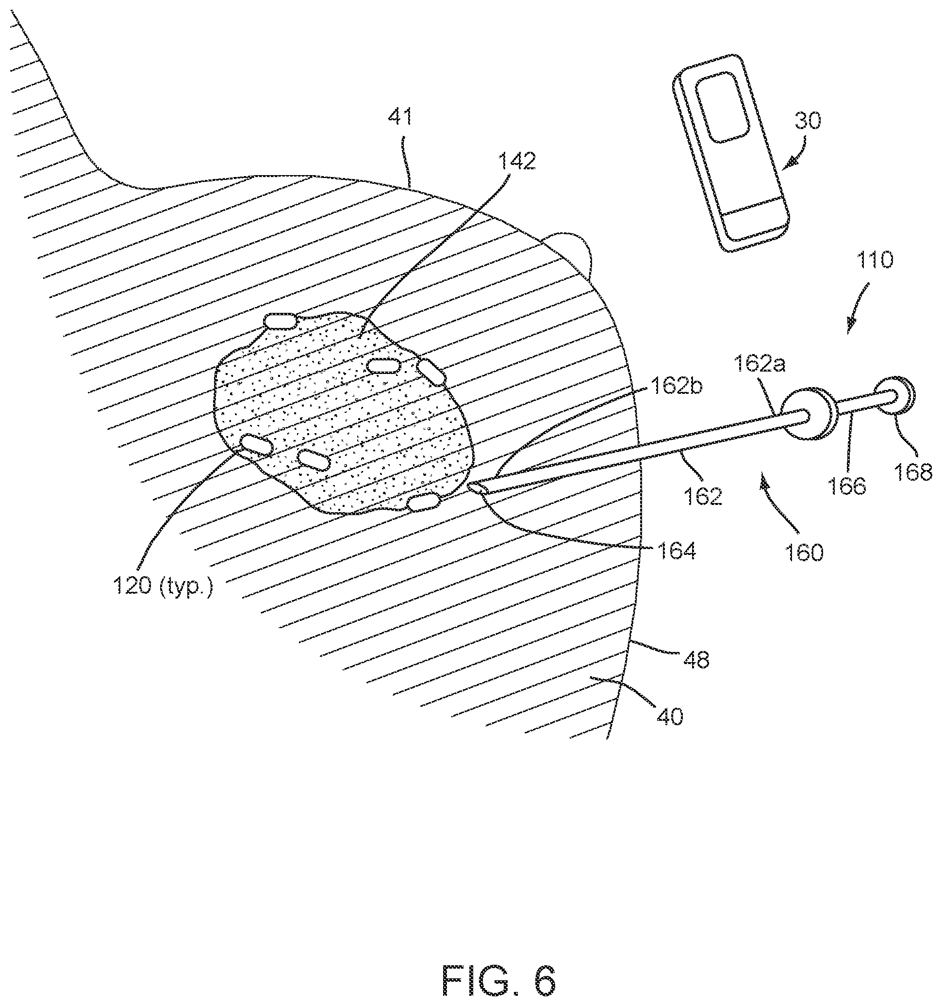 Patent US12588829 Figure 7 – Apparatus, systems, and methods for localizing markers or tissue structures within a body