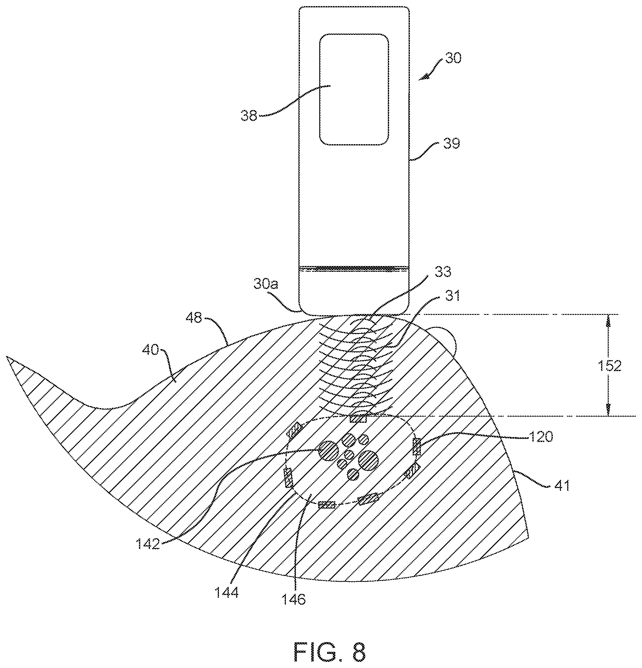Patent US12588829 Figure 9 – Apparatus, systems, and methods for localizing markers or tissue structures within a body