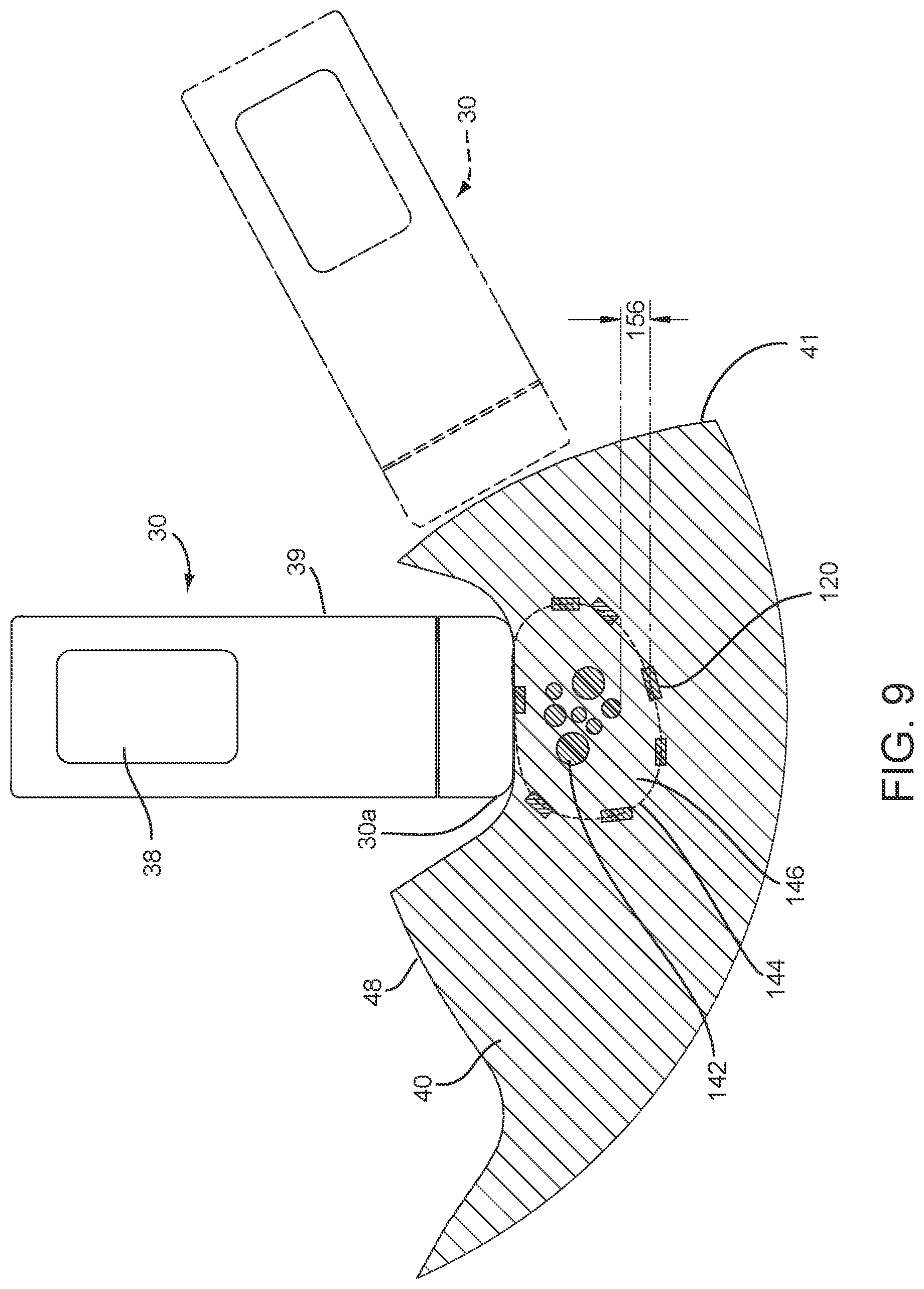 Patent US12588829 Figure 10 – Apparatus, systems, and methods for localizing markers or tissue structures within a body