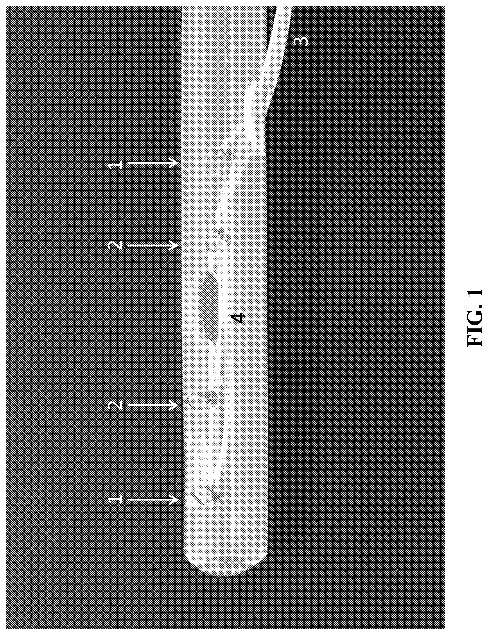 Patent US12588831 Figure 1 – Method for monitoring lung integrity