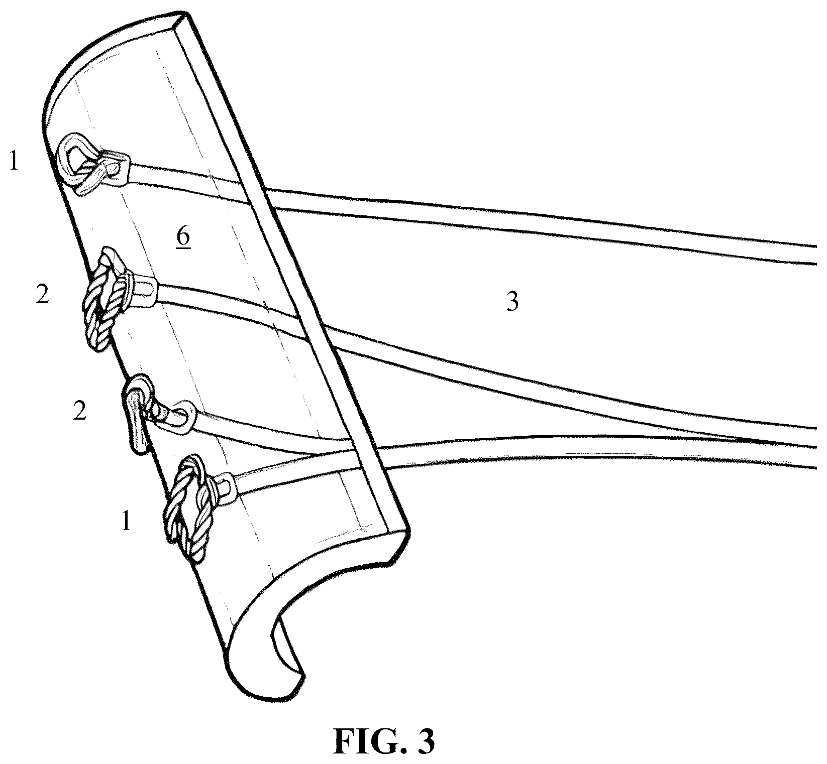 Patent US12588831 Figure 3 – Method for monitoring lung integrity