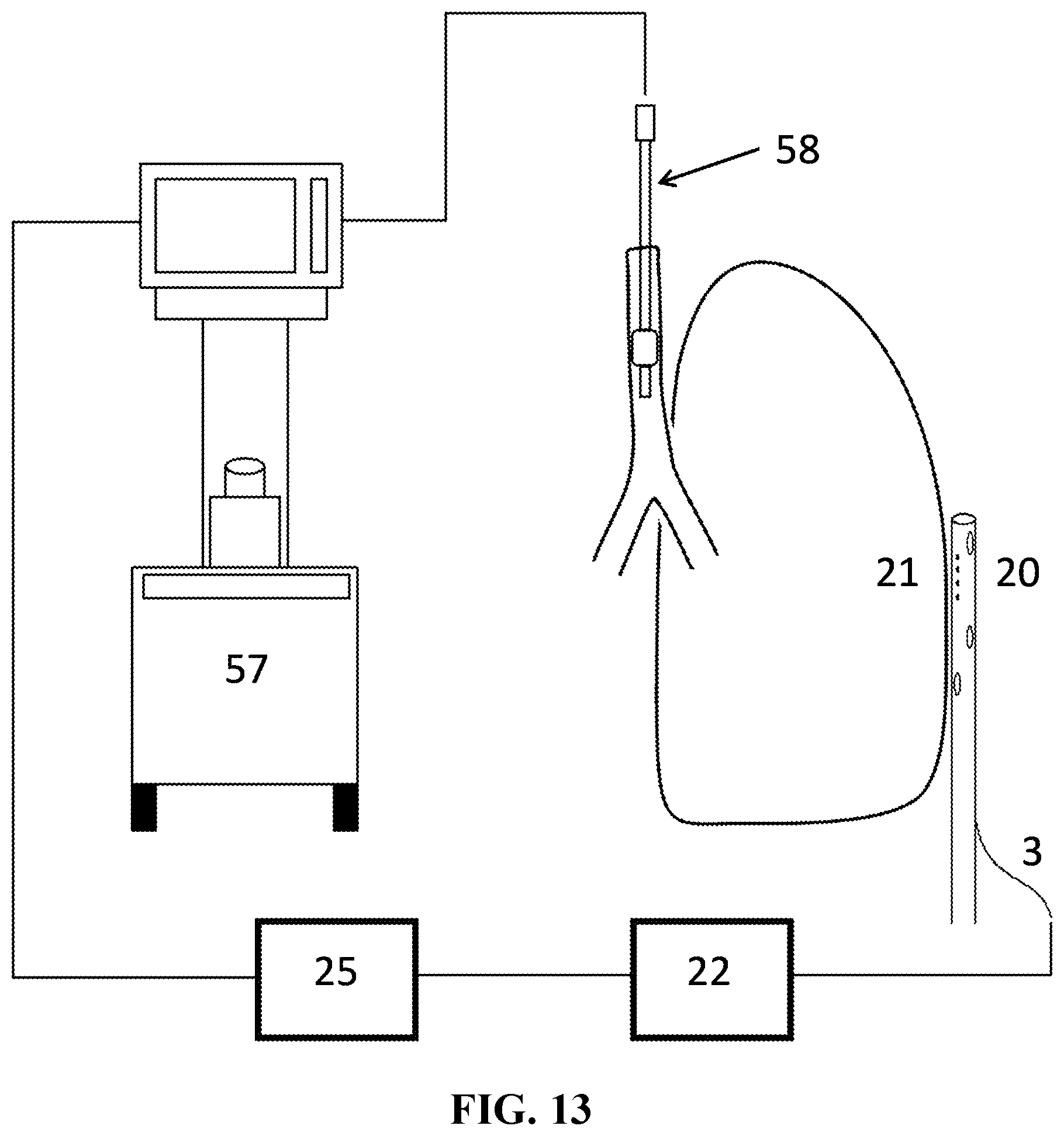 Patent US12588831 Figure 13 – Method for monitoring lung integrity