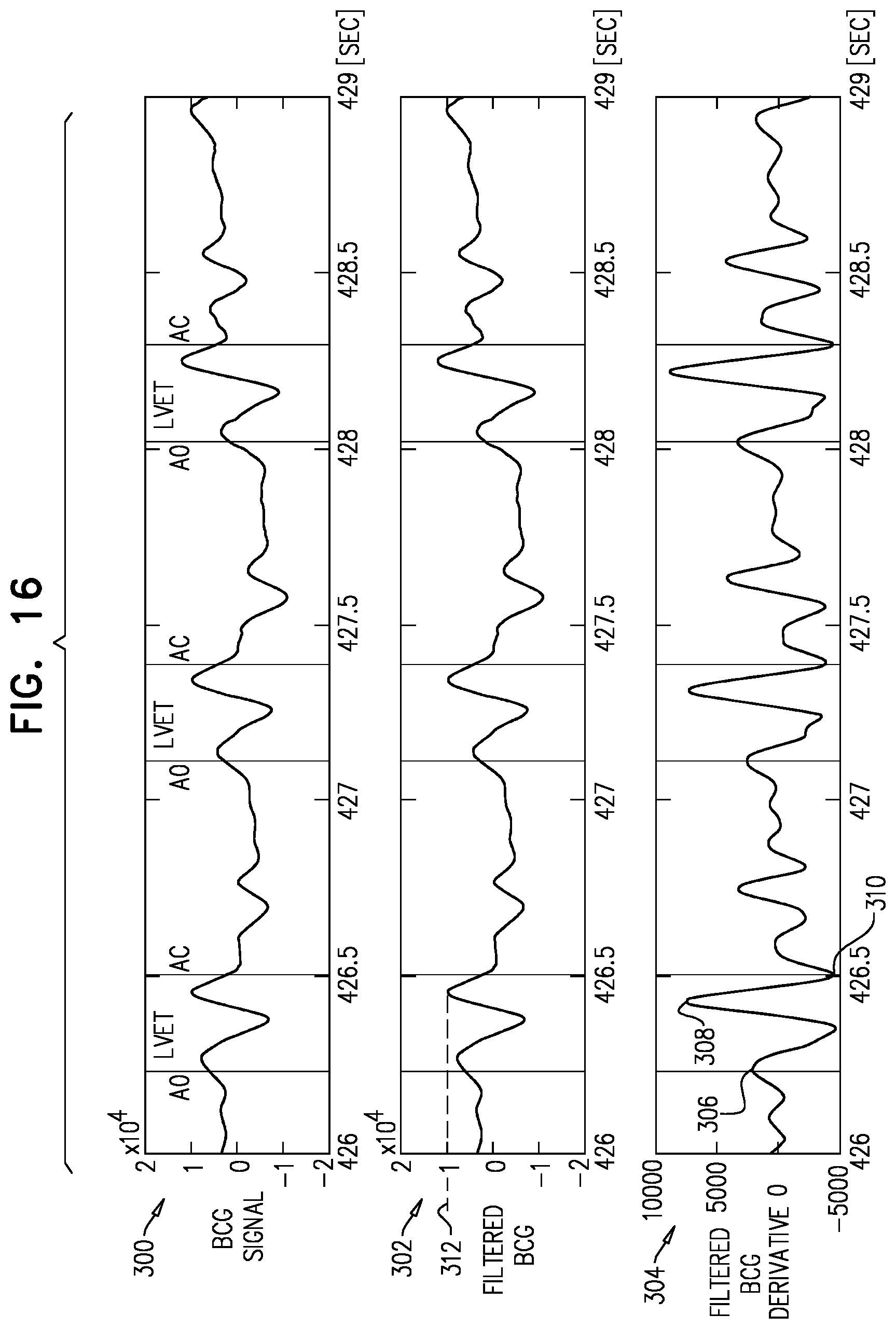 Patent US12588833 Figure 15 – Monitoring a sleeping subject