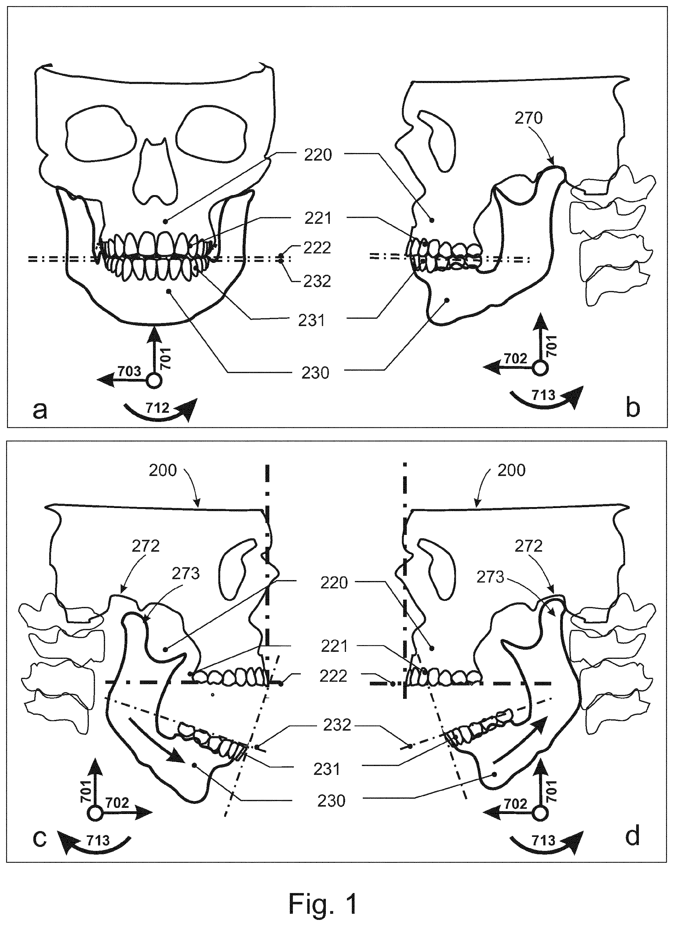 Patent US12588834 Figure 1 – Device, system and method for movement tracking