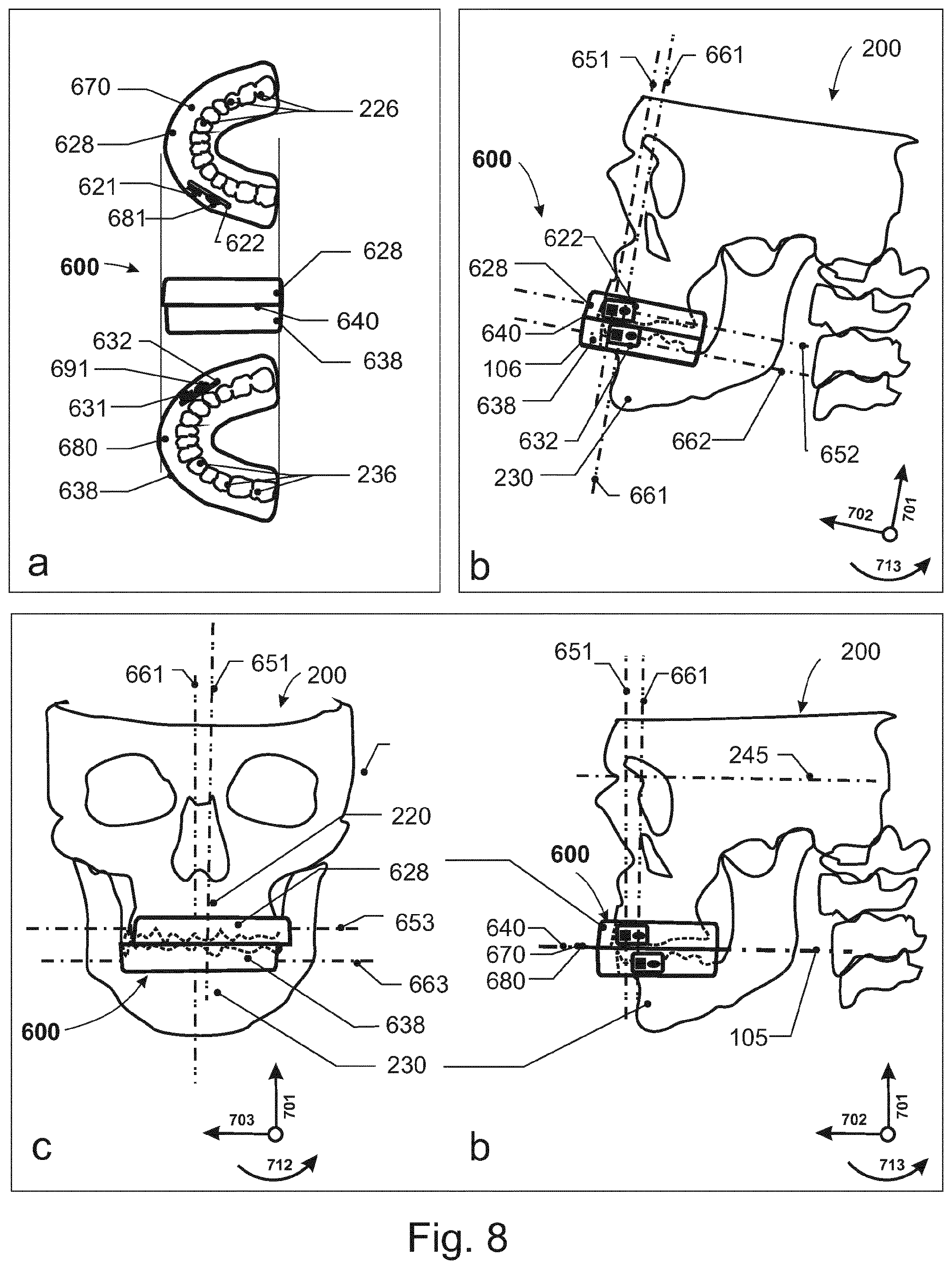 Patent US12588834 Figure 8 – Device, system and method for movement tracking
