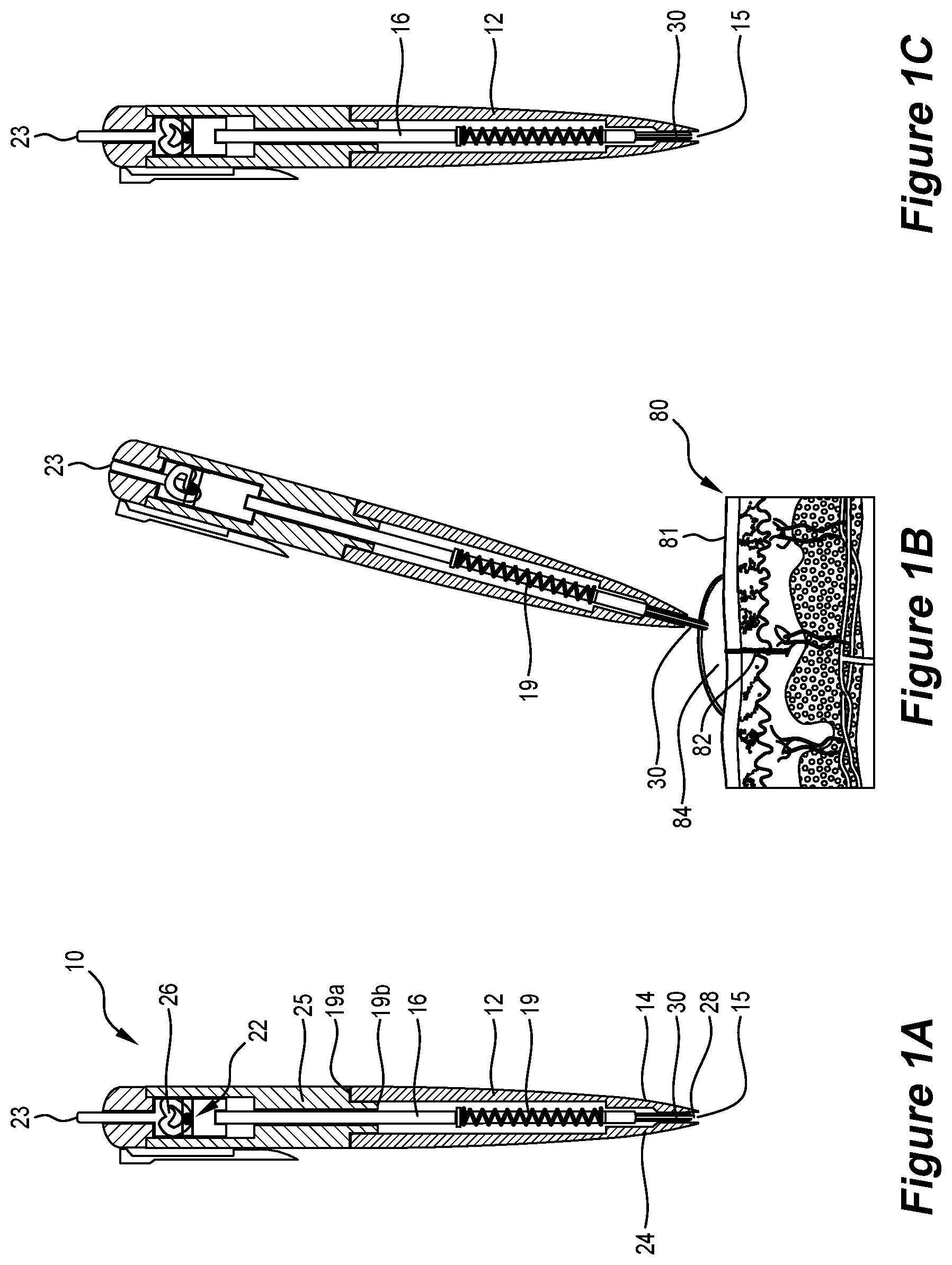 Patent US12588845 Figure 1 – Liquid collection device