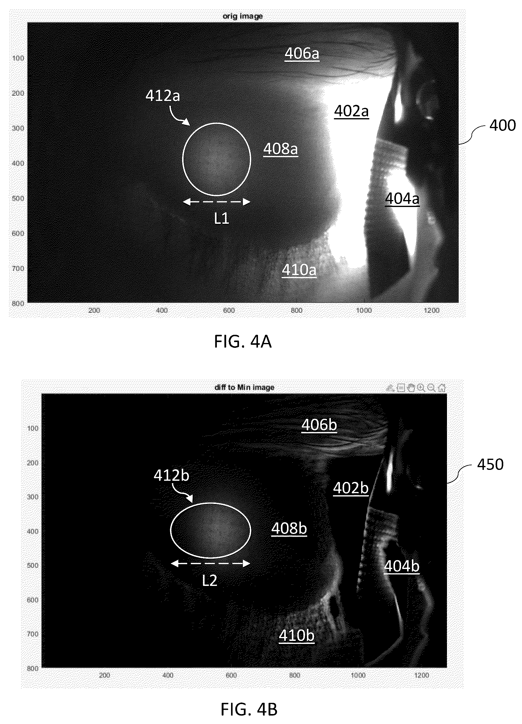 Patent US12588846 Figure 4 – Methods, systems, and devices for determining a status of brain and/or nerve functions of a patient
