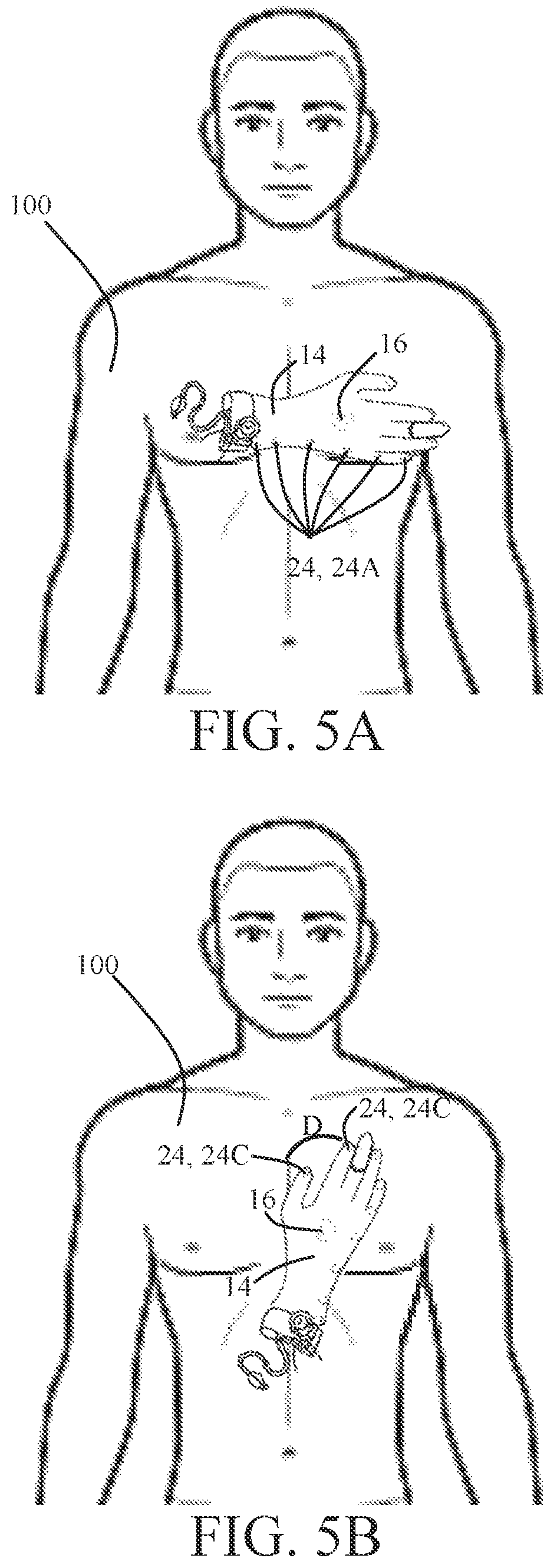 Patent US12588849 Figure 4 – Garment medical examination system