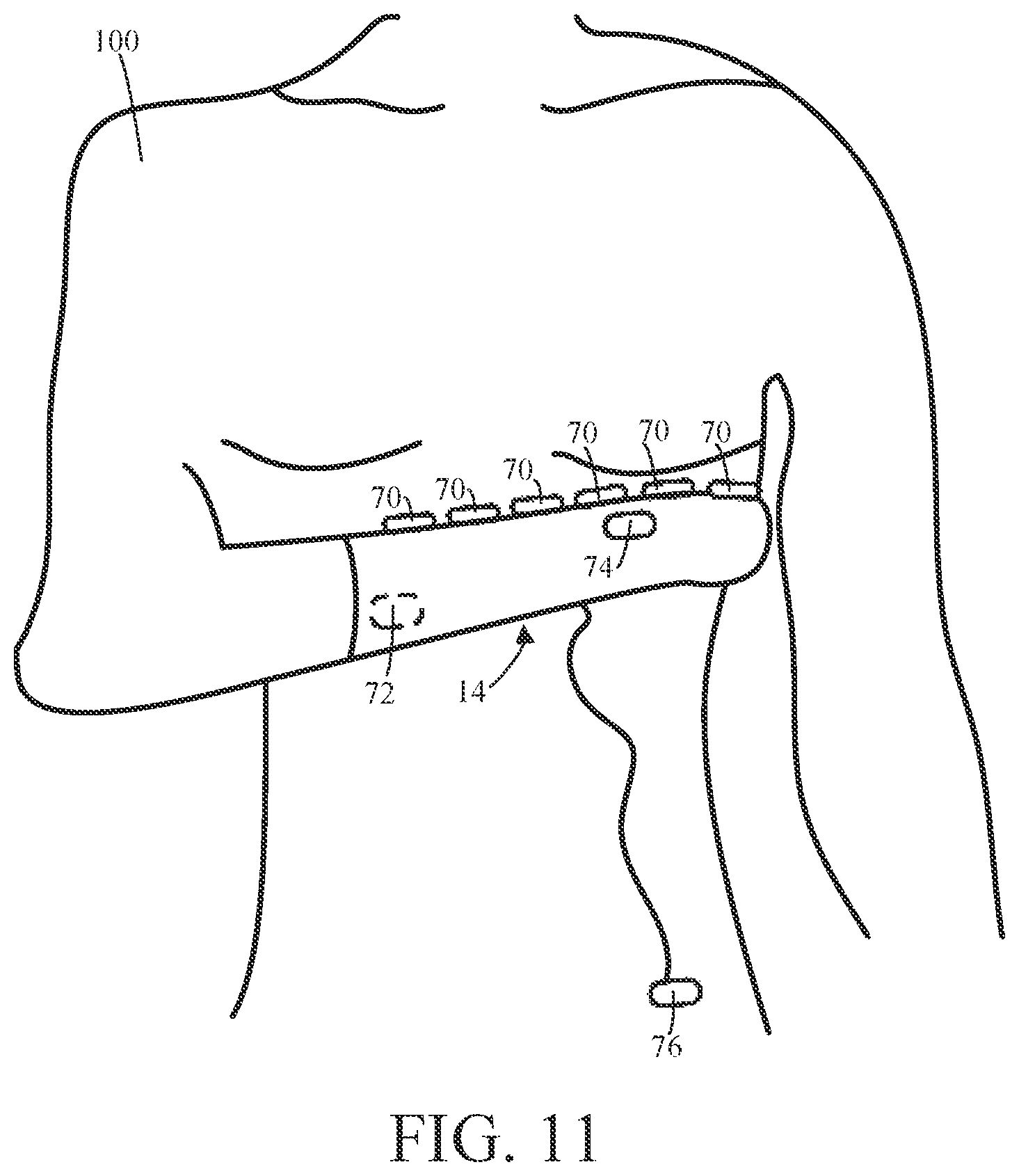 Patent US12588849 Figure 11 – Garment medical examination system