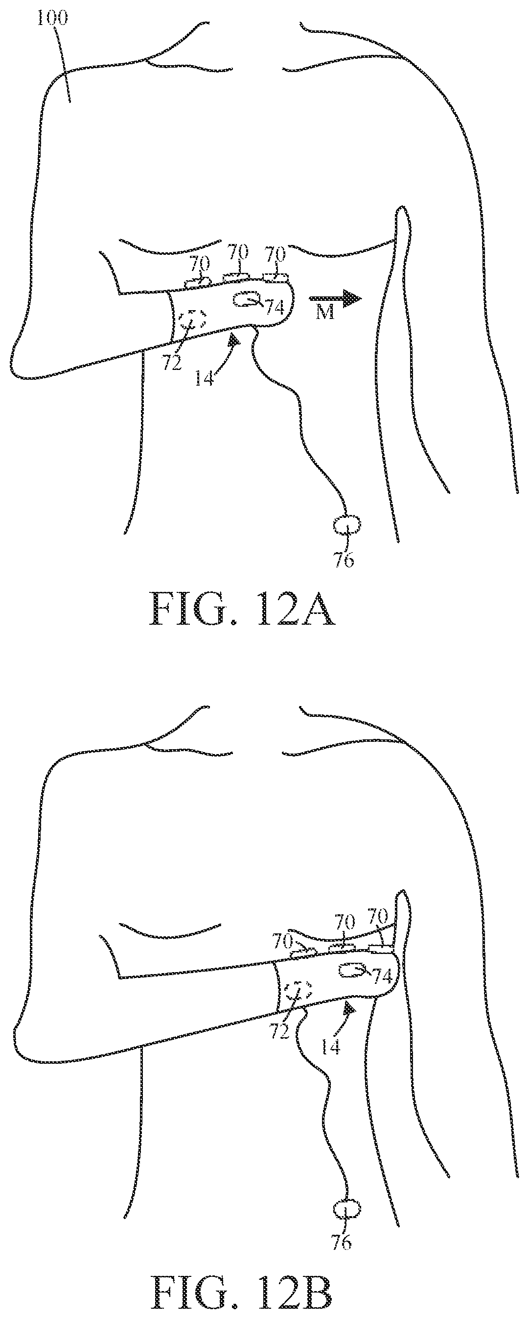 Patent US12588849 Figure 12 – Garment medical examination system