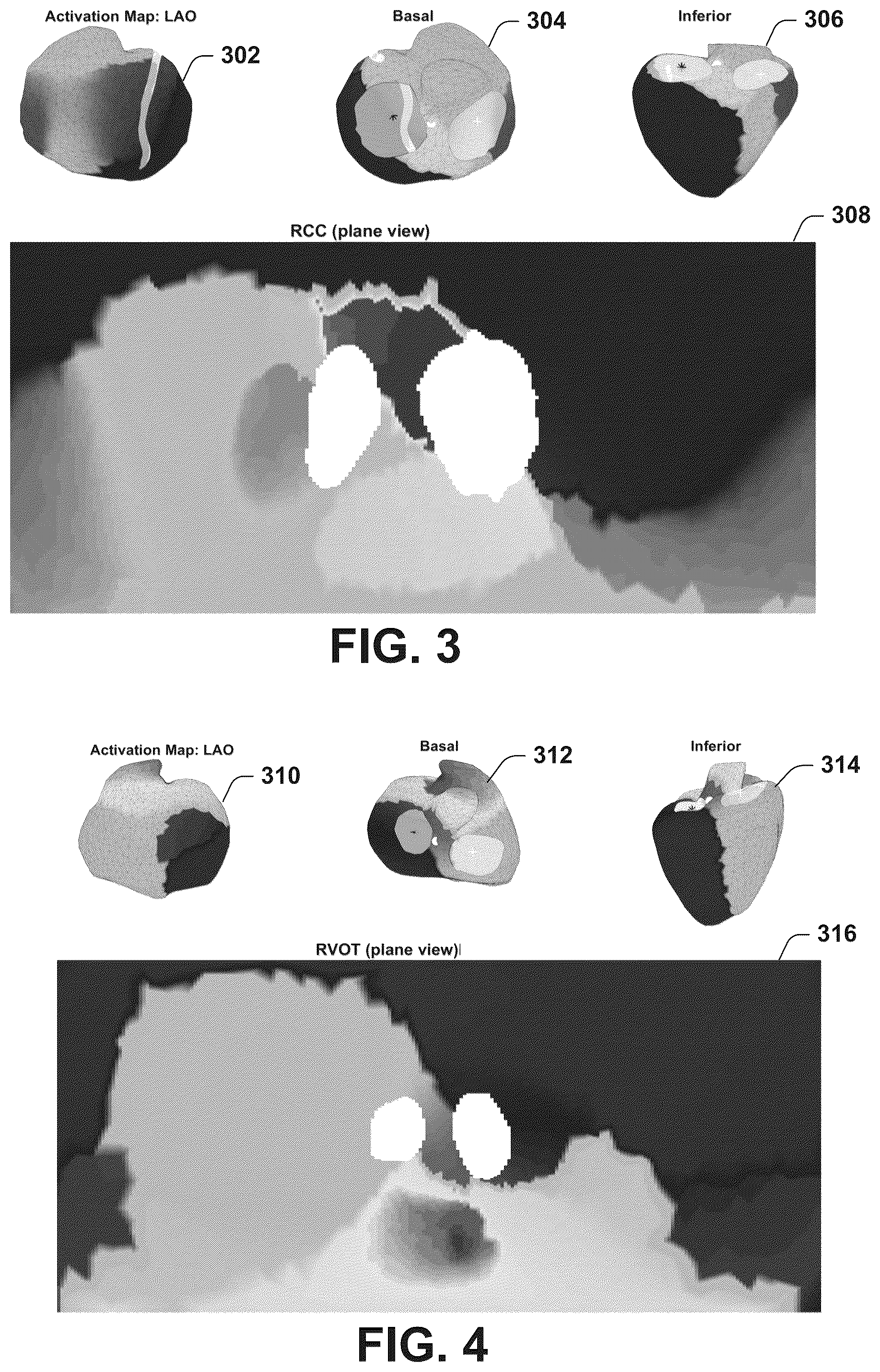 Patent US12588850 Figure 3 – Monitoring and analysis of invasive and non-invasive electrophysiological signals
