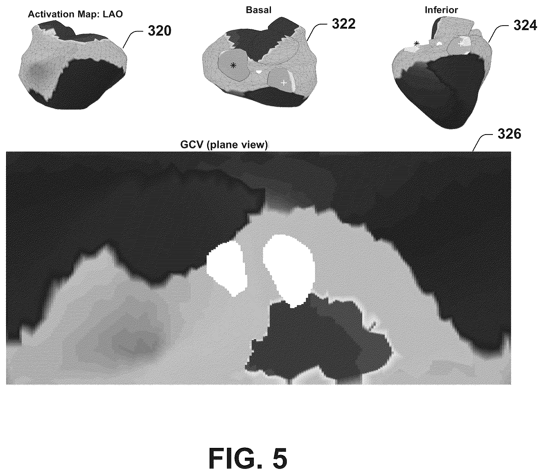 Patent US12588850 Figure 4 – Monitoring and analysis of invasive and non-invasive electrophysiological signals