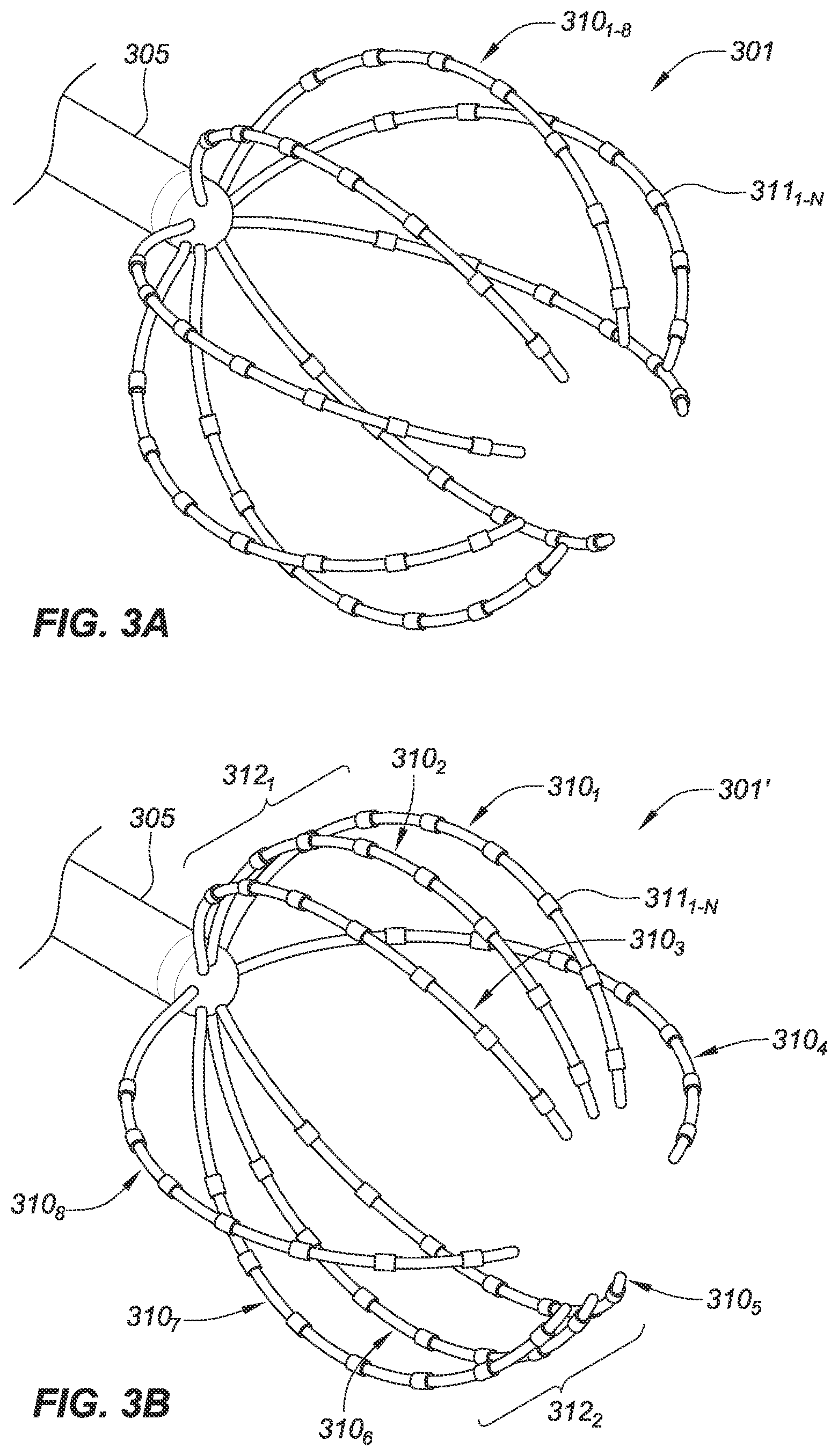 Patent US12588851 Figure 6 – Variable density mapping catheter