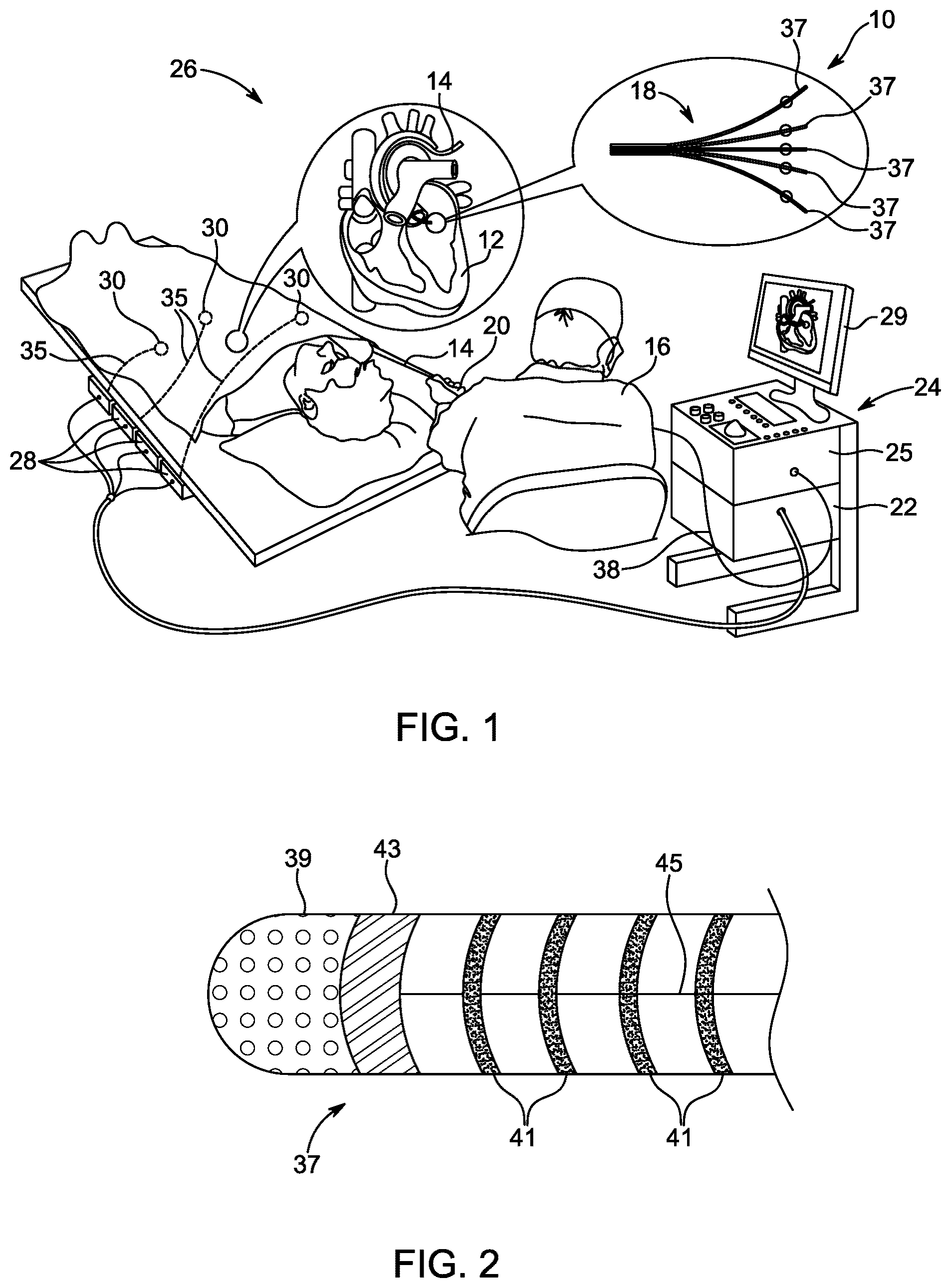 Patent US12588854 — Algorithm for optimal beat selection — Figure 1