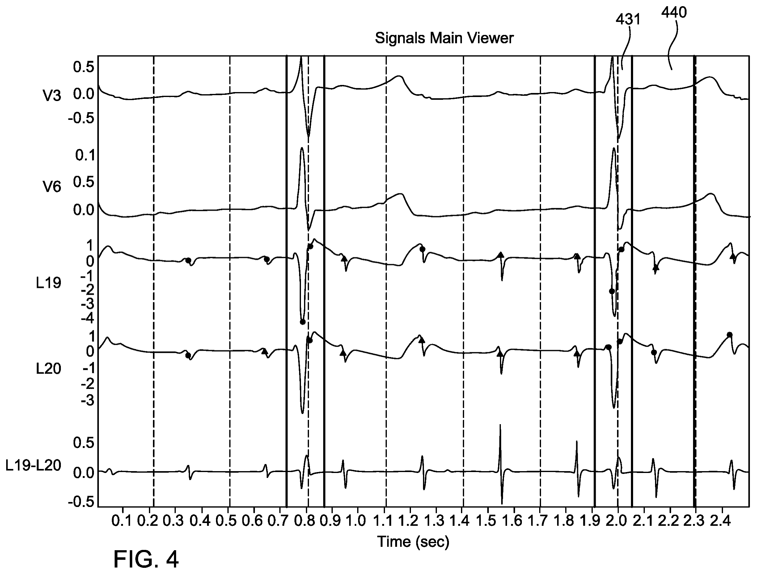 Patent US12588854 Figure 3 – Algorithm for optimal beat selection