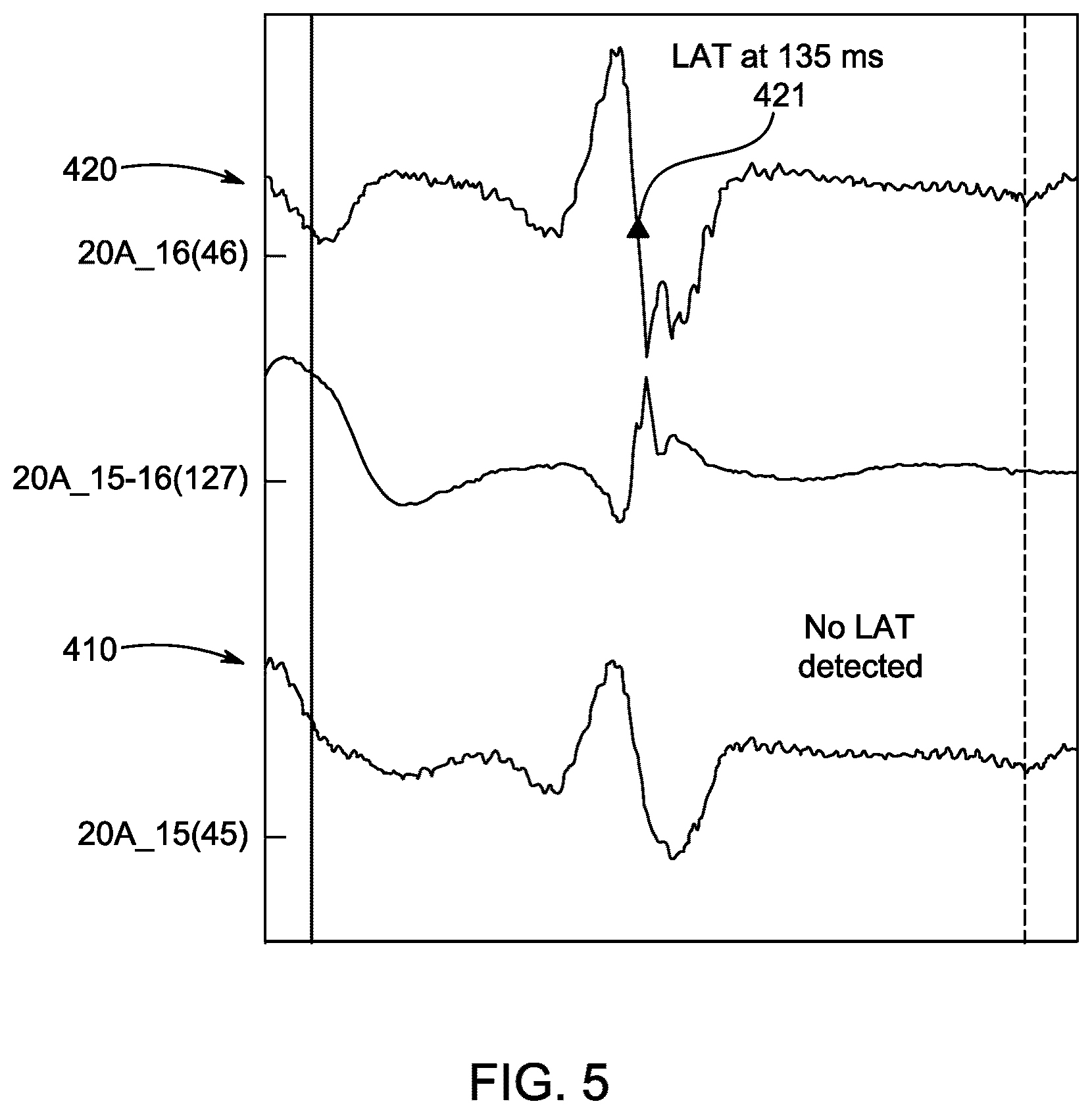Patent US12588854 Figure 4 – Algorithm for optimal beat selection