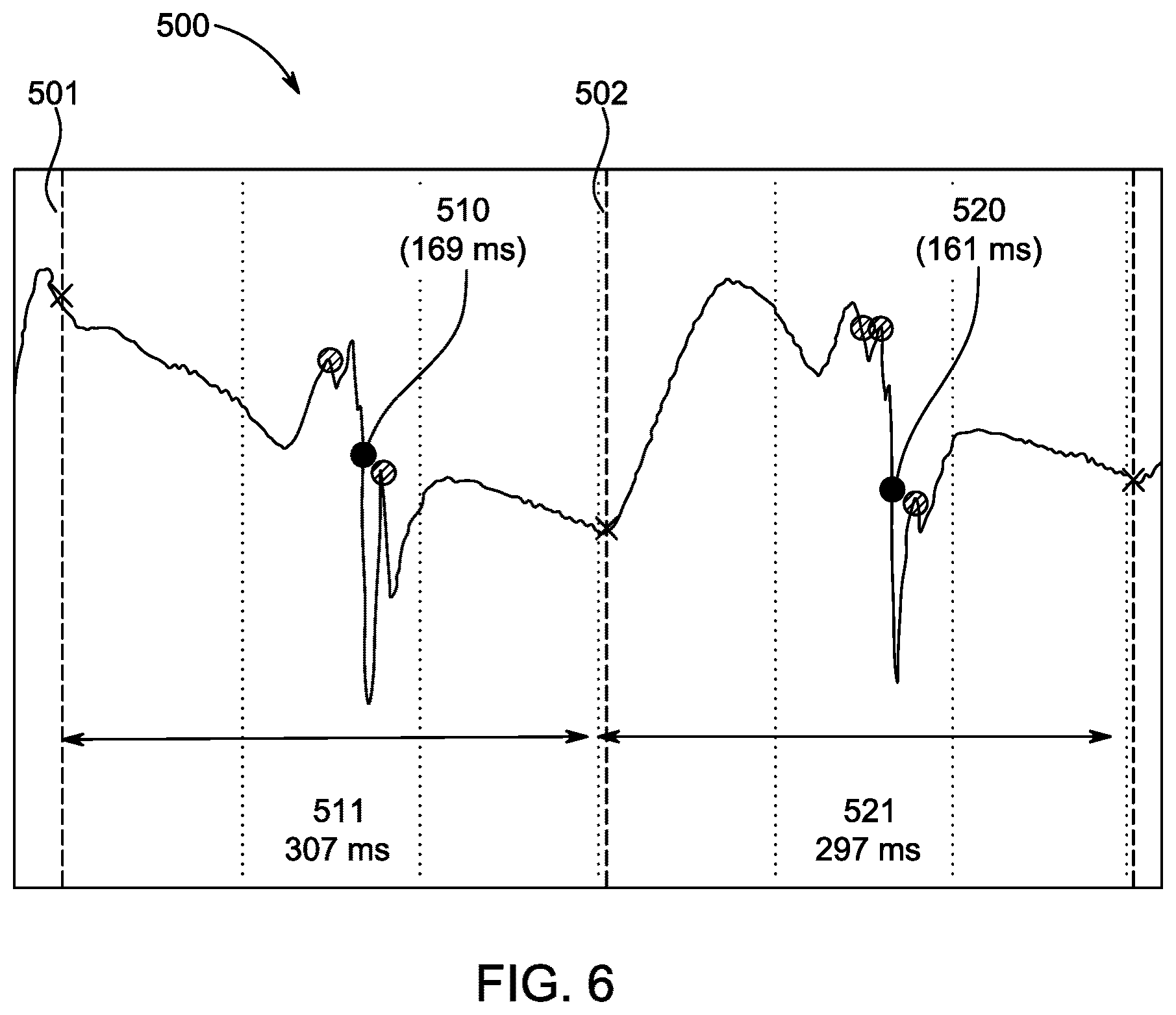 Patent US12588854 Figure 5 – Algorithm for optimal beat selection