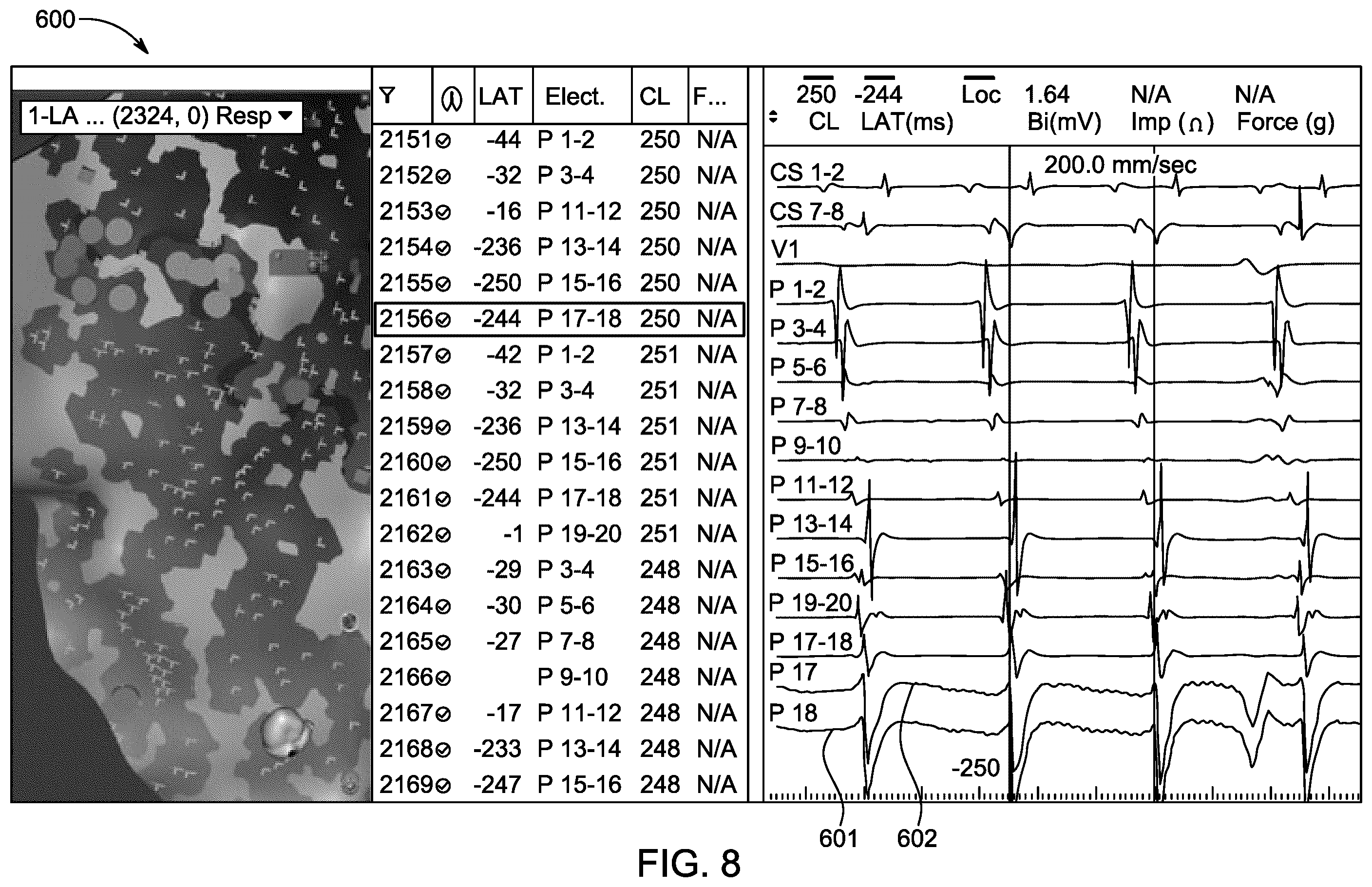 Patent US12588854 Figure 7 – Algorithm for optimal beat selection