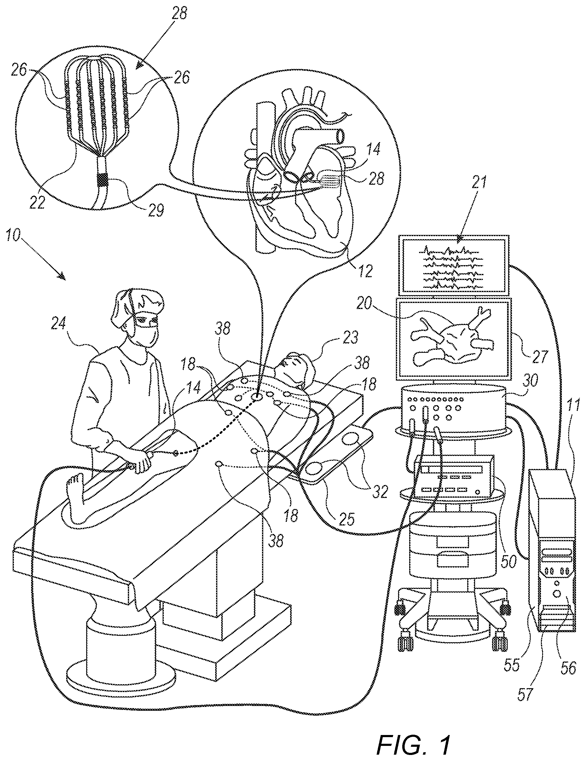 Patent US12588856 Figure 1 – Identifying and indicating cardiac areas exhibiting progressively slowing activation (PSA)