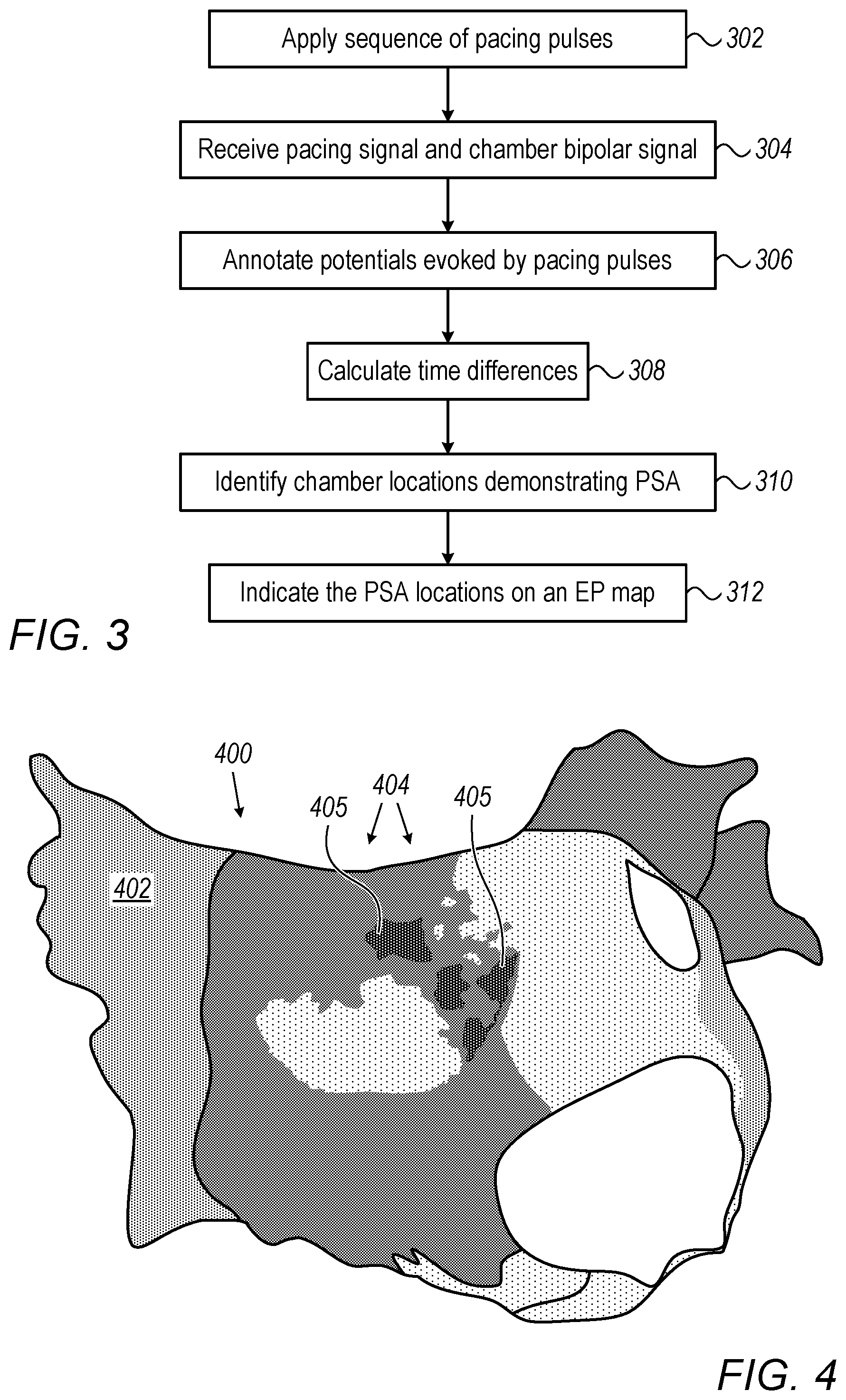 Patent US12588856 Figure 3 – Identifying and indicating cardiac areas exhibiting progressively slowing activation (PSA)