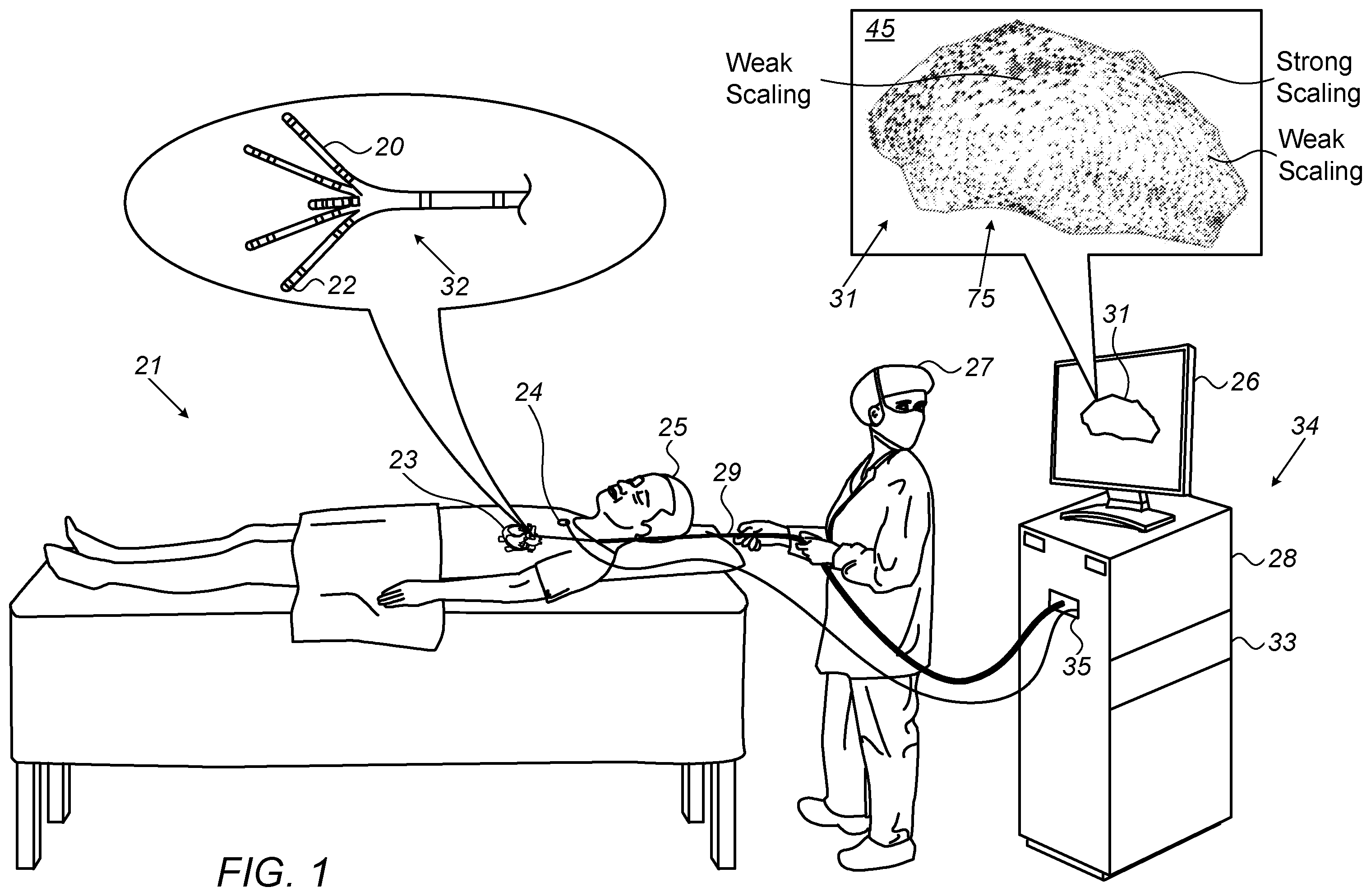 Patent US12588858 Figure 1 – Weighting projected electrophysiological wave velocity with sigmoid curve