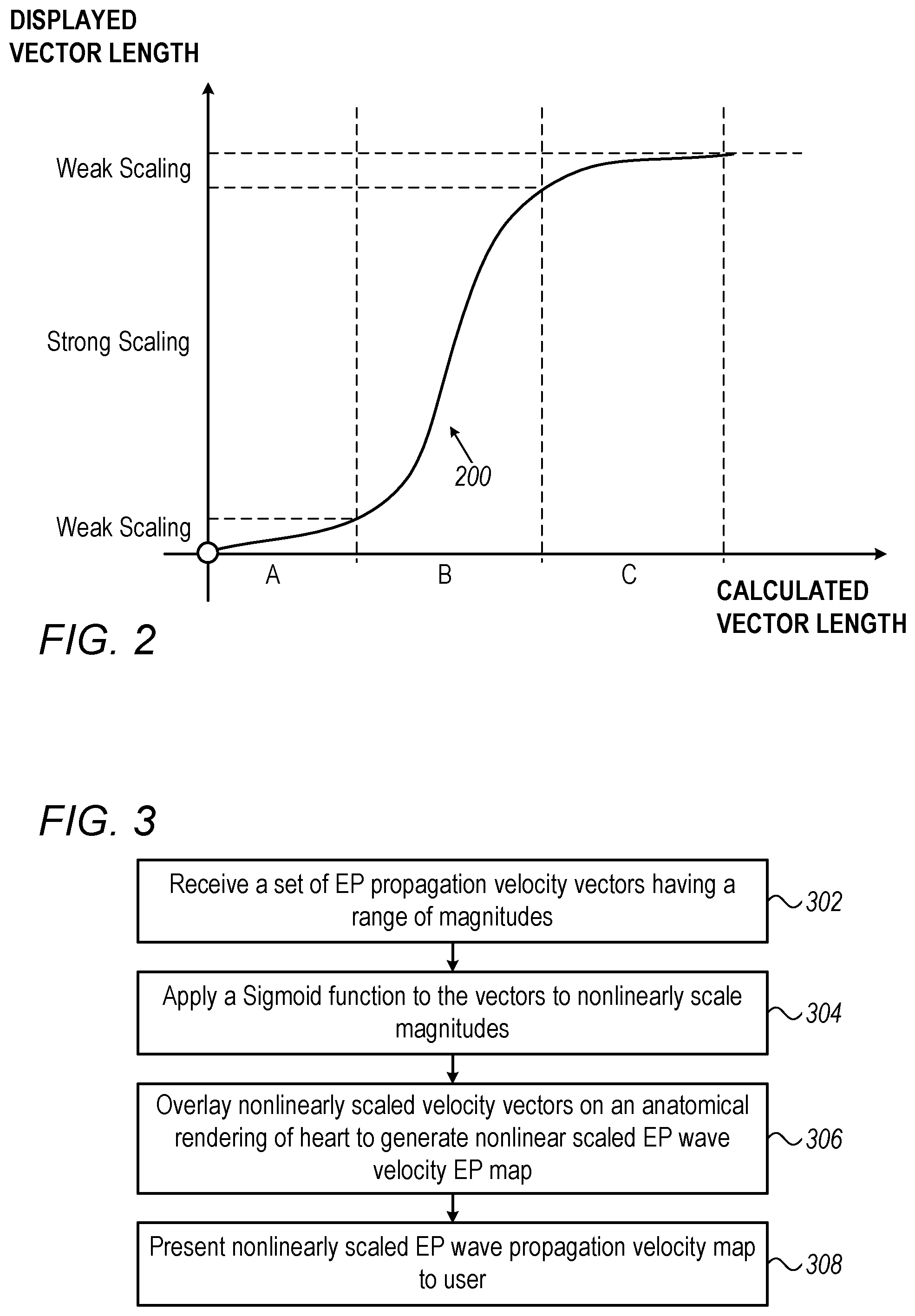 Patent US12588858 Figure 2 – Weighting projected electrophysiological wave velocity with sigmoid curve