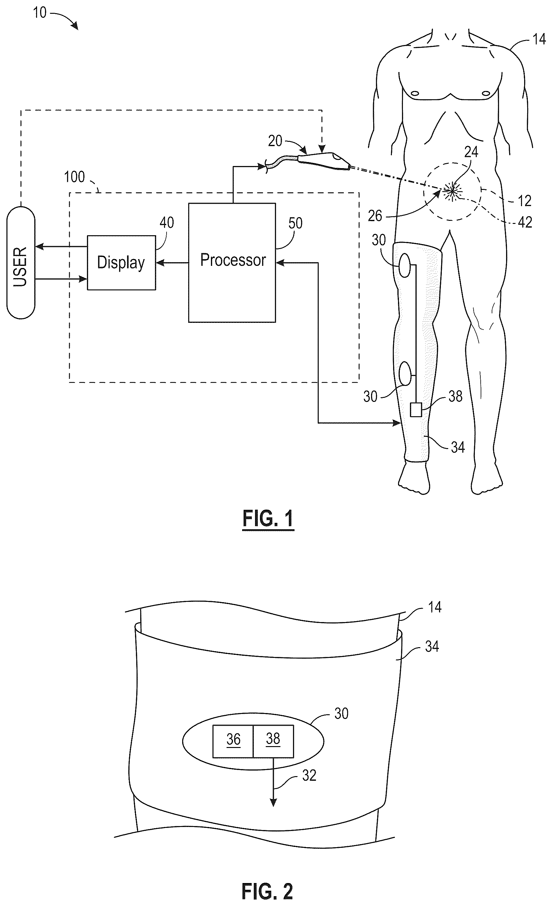 Patent US12588860 Figure 1 – System and method for intraoperative guidance