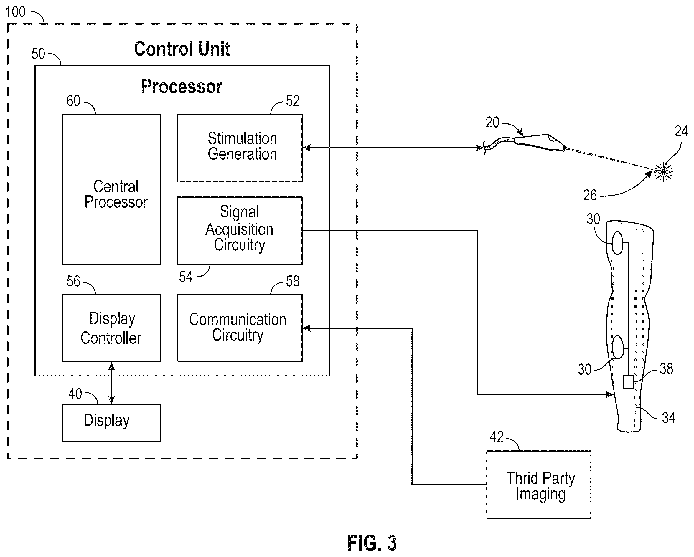 Patent US12588860 Figure 2 – System and method for intraoperative guidance