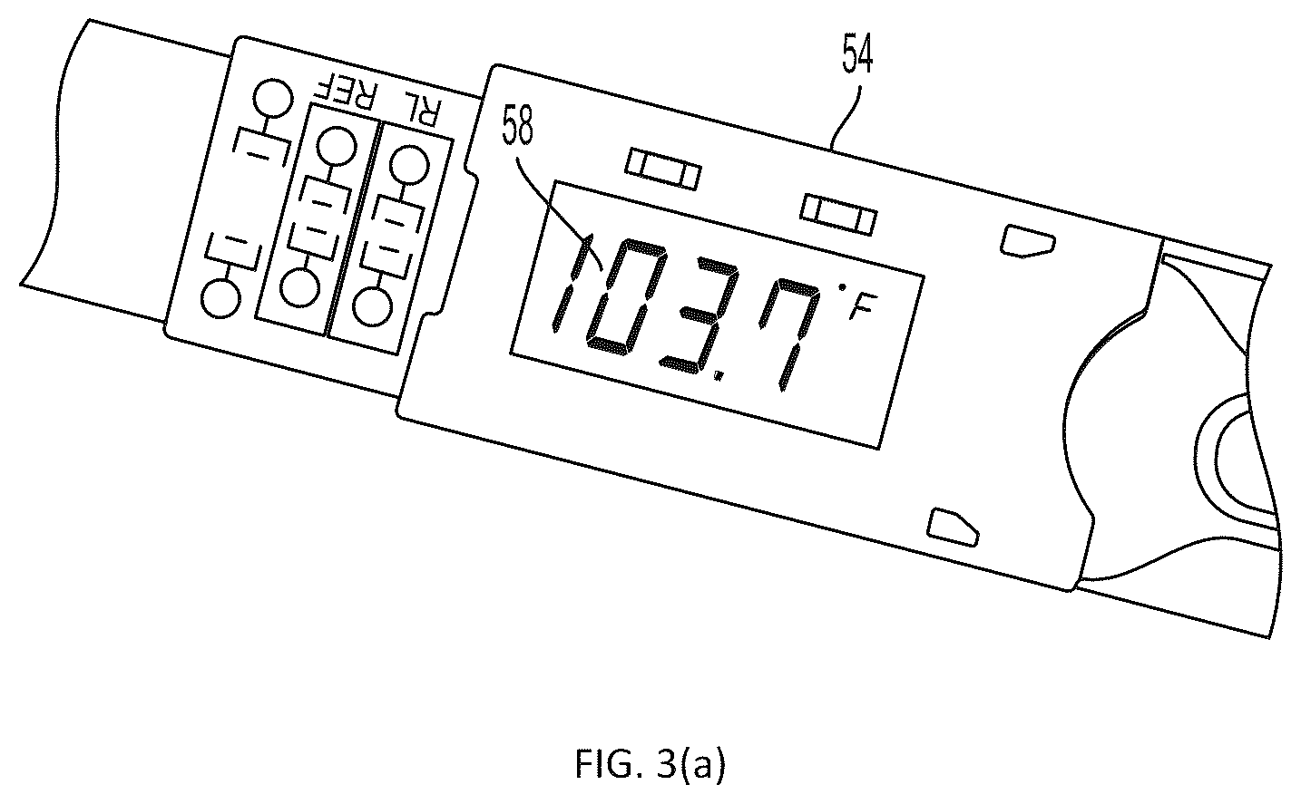 Patent US12588862 Figure 3 – System and method for allergen-specific epicutaneous immunotherapy