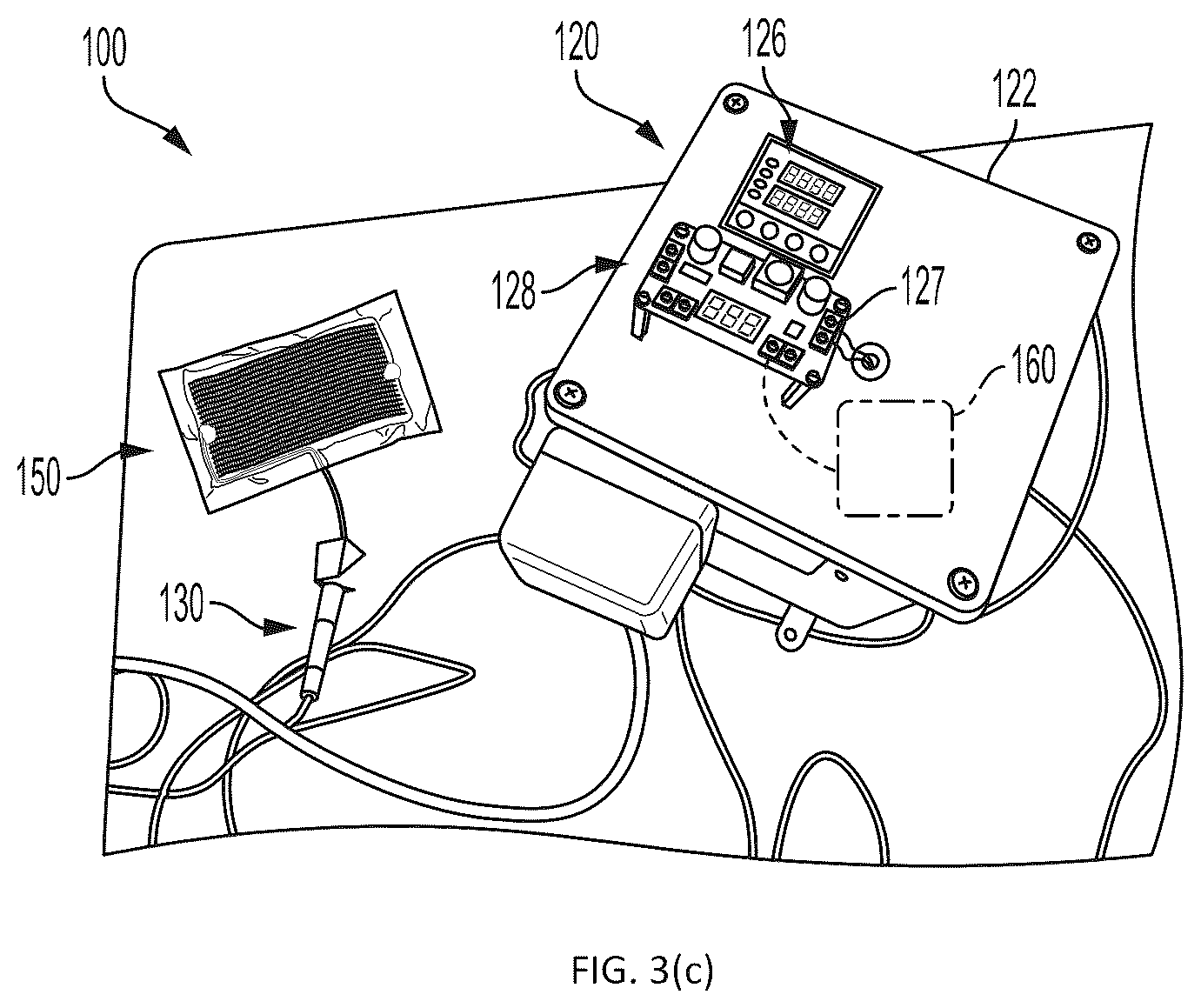 Patent US12588862 Figure 5 – System and method for allergen-specific epicutaneous immunotherapy