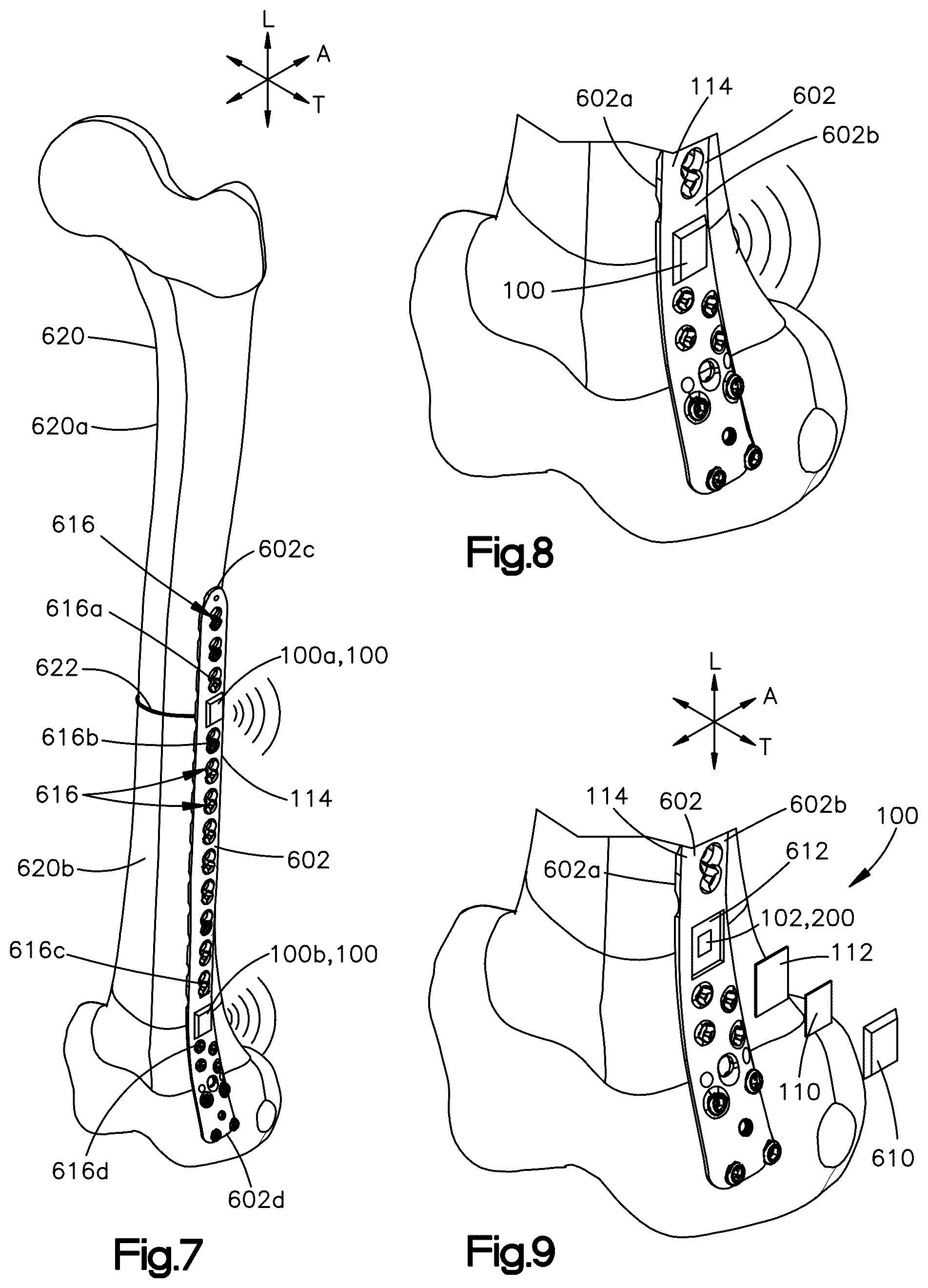 Patent US12588864 Figure 5 – Sensors implantable into a patient's body, systems, and methods of using the same