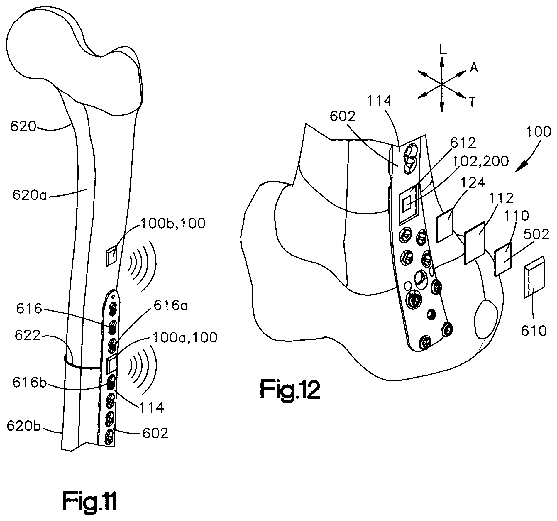 Patent US12588864 Figure 6 – Sensors implantable into a patient's body, systems, and methods of using the same