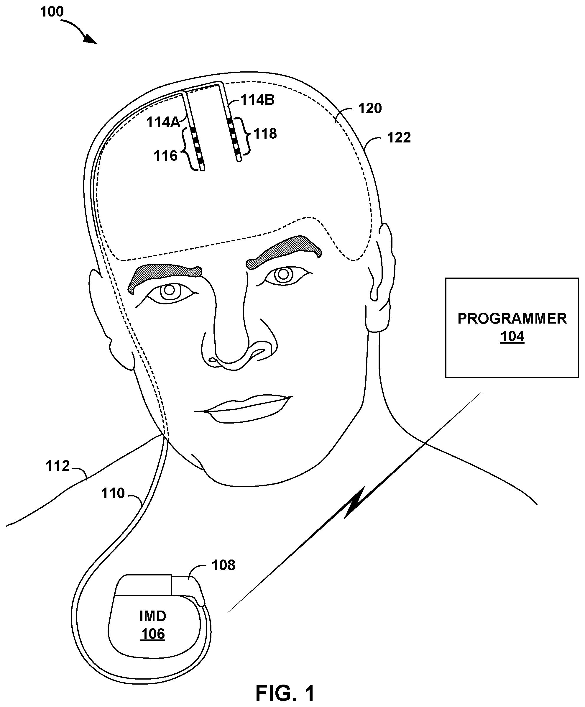 Patent US12588870 Figure 1 – Electrode orientation detection