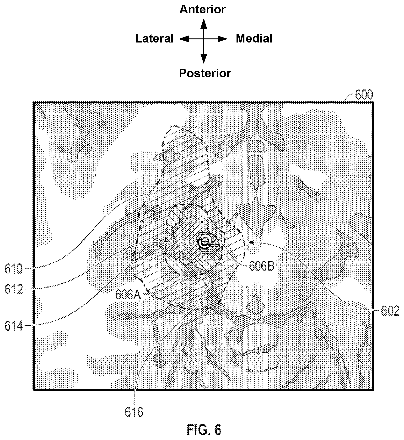 Patent US12588870 Figure 6 – Electrode orientation detection