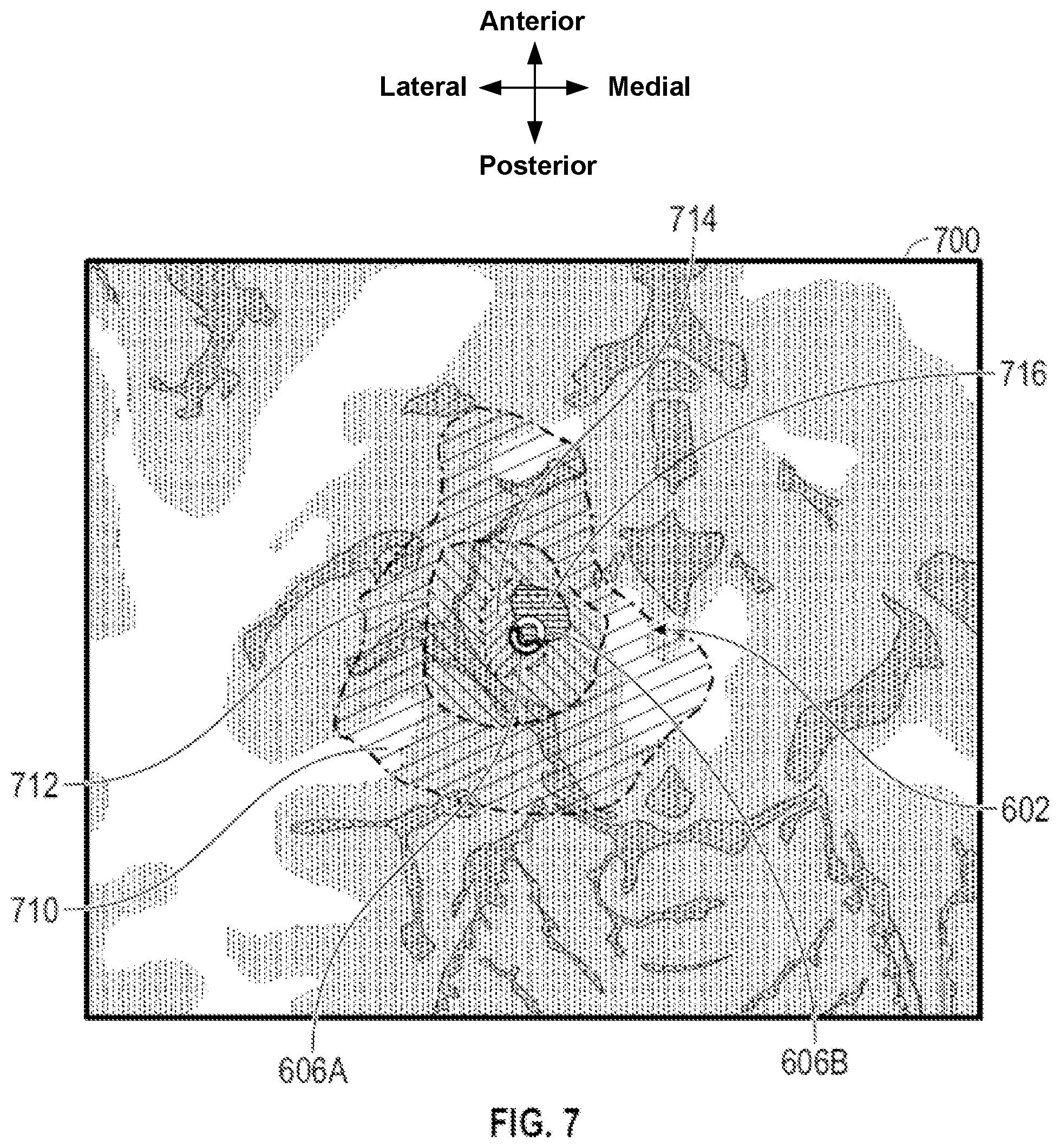 Patent US12588870 Figure 7 – Electrode orientation detection