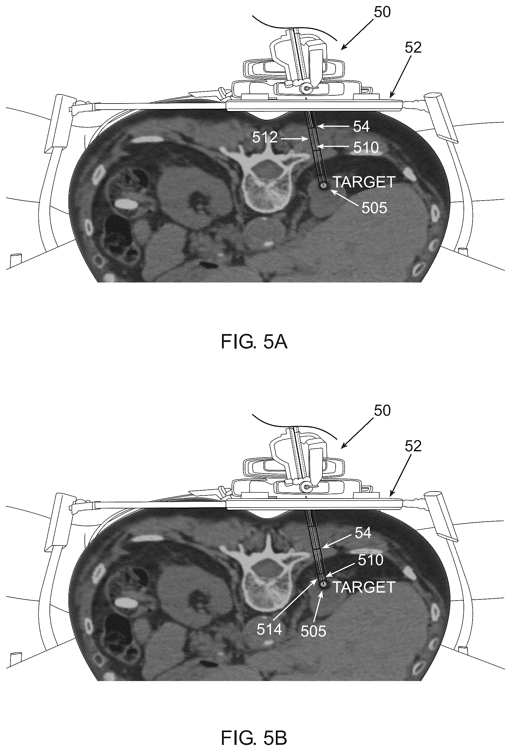 Patent US12588874 Figure 8 – Optimizing checkpoint locations along an insertion trajectory of a medical instrument using data analysis