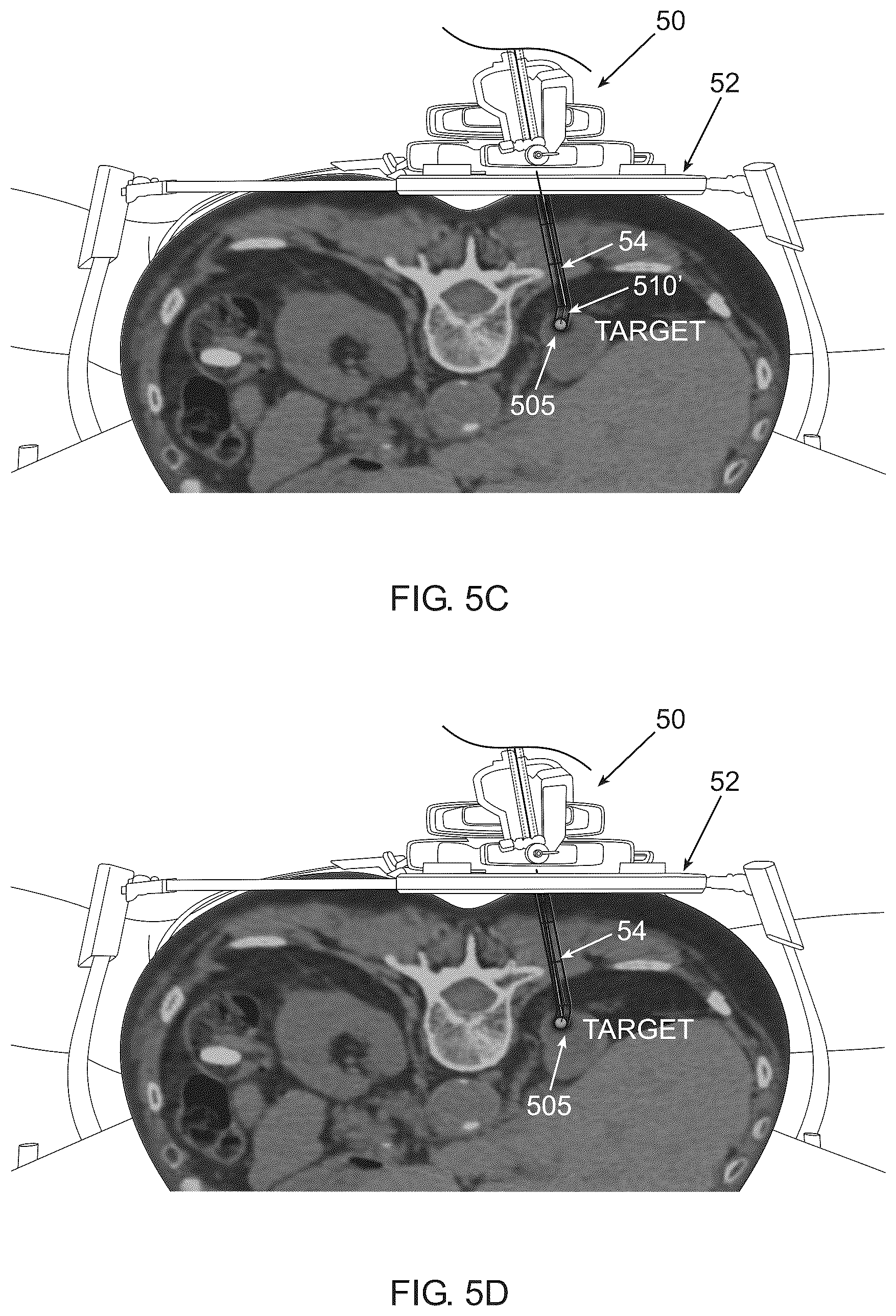 Patent US12588874 Figure 9 – Optimizing checkpoint locations along an insertion trajectory of a medical instrument using data analysis