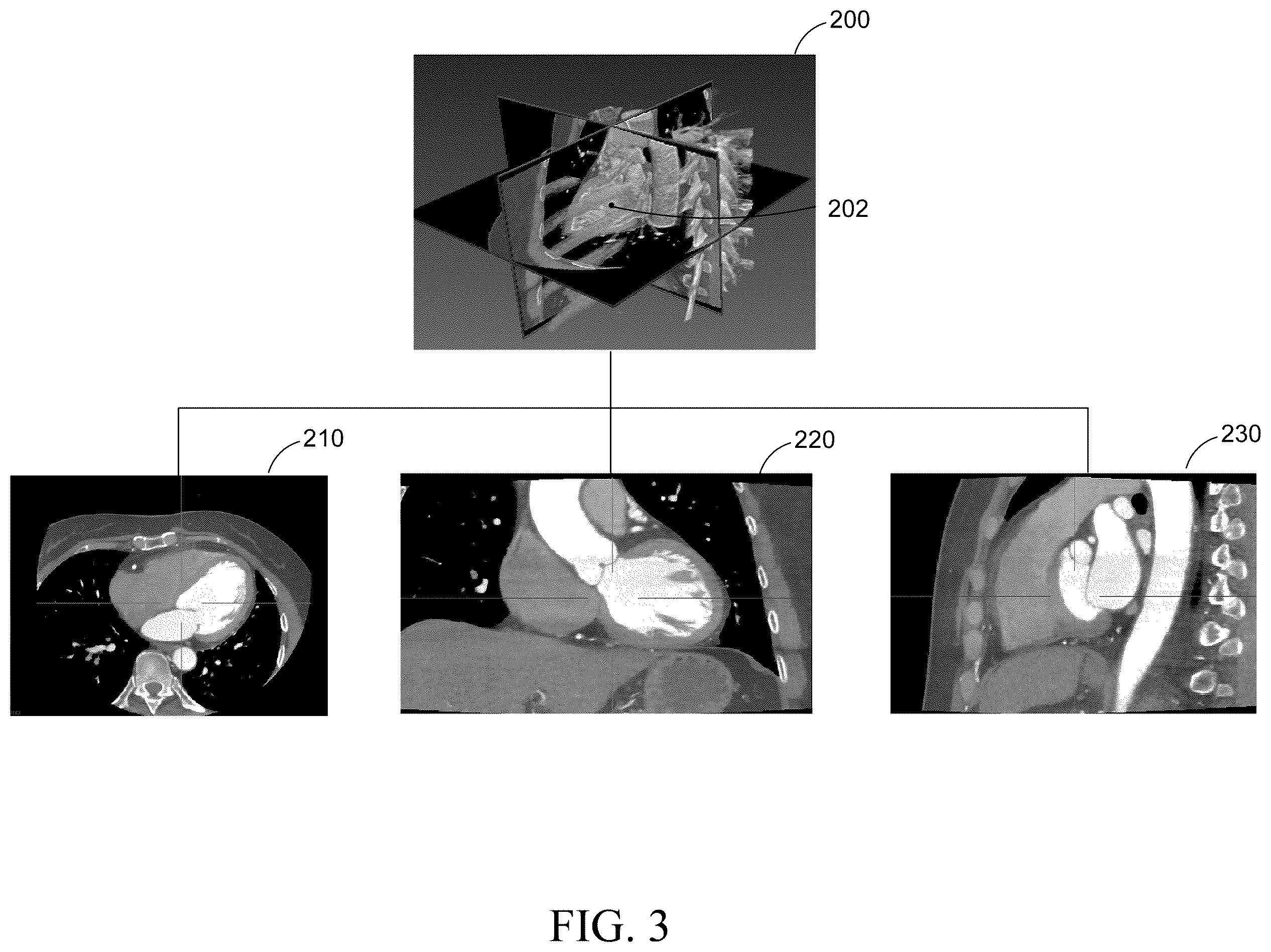 Patent US12588876 Figure 3 – Target area determination method and medical imaging system