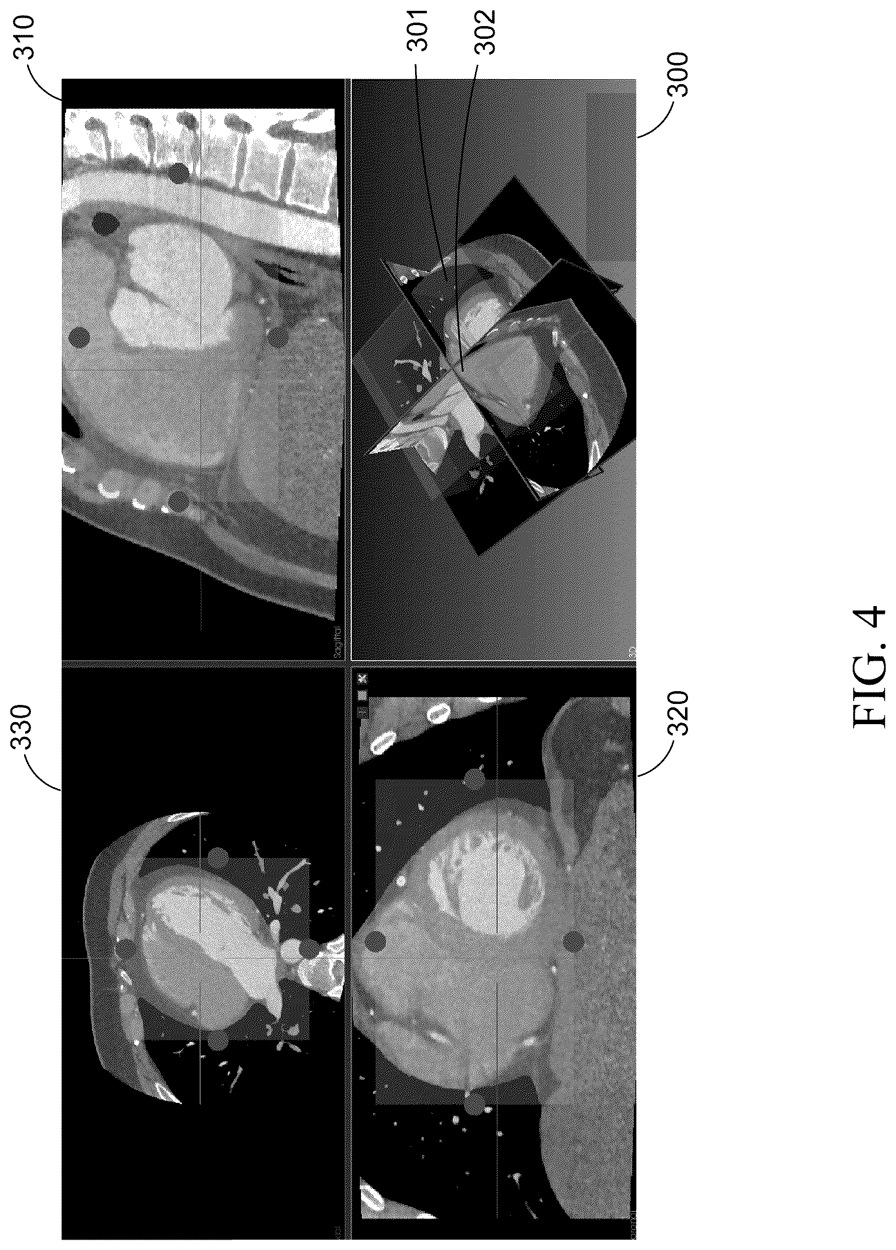 Patent US12588876 Figure 4 – Target area determination method and medical imaging system