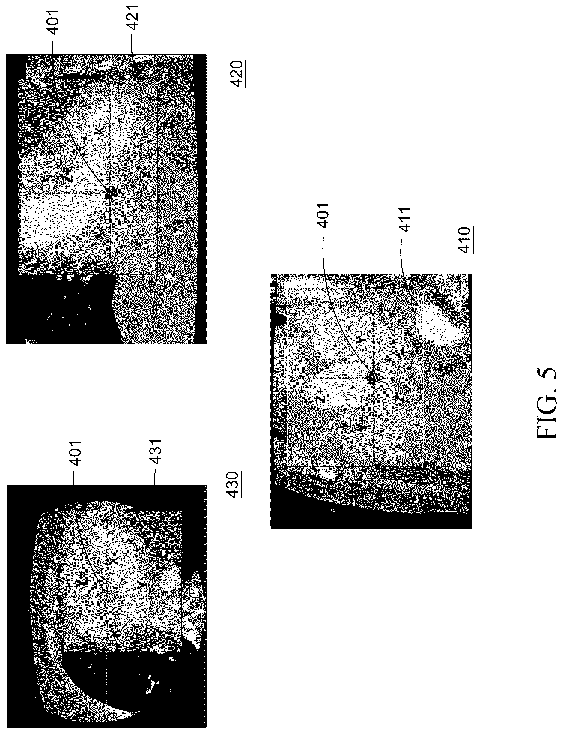 Patent US12588876 Figure 5 – Target area determination method and medical imaging system